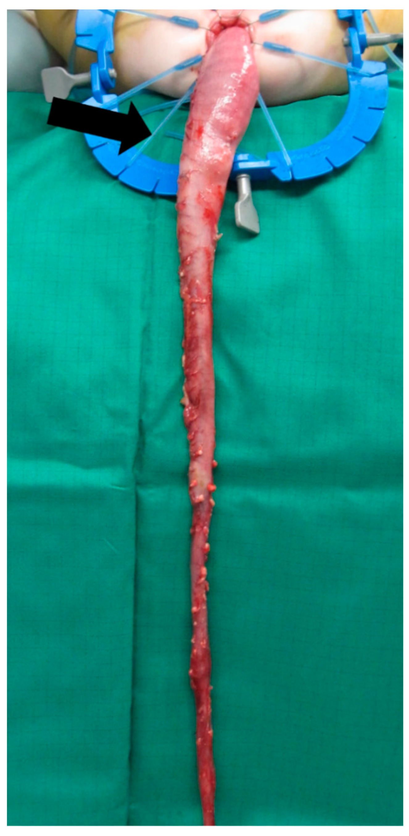 Children 09 00588 g005 Children 09 00588 g005