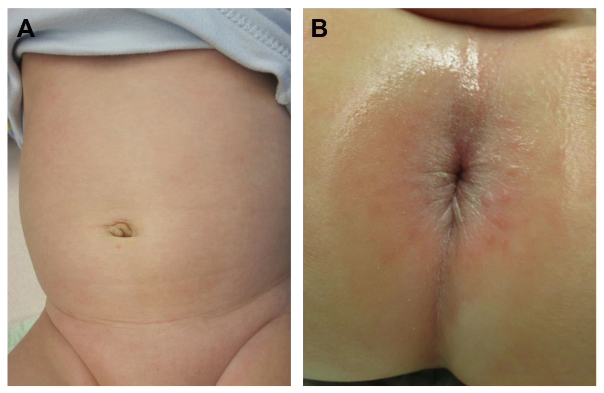 Children 09 00588 g006 Children 09 00588 g006