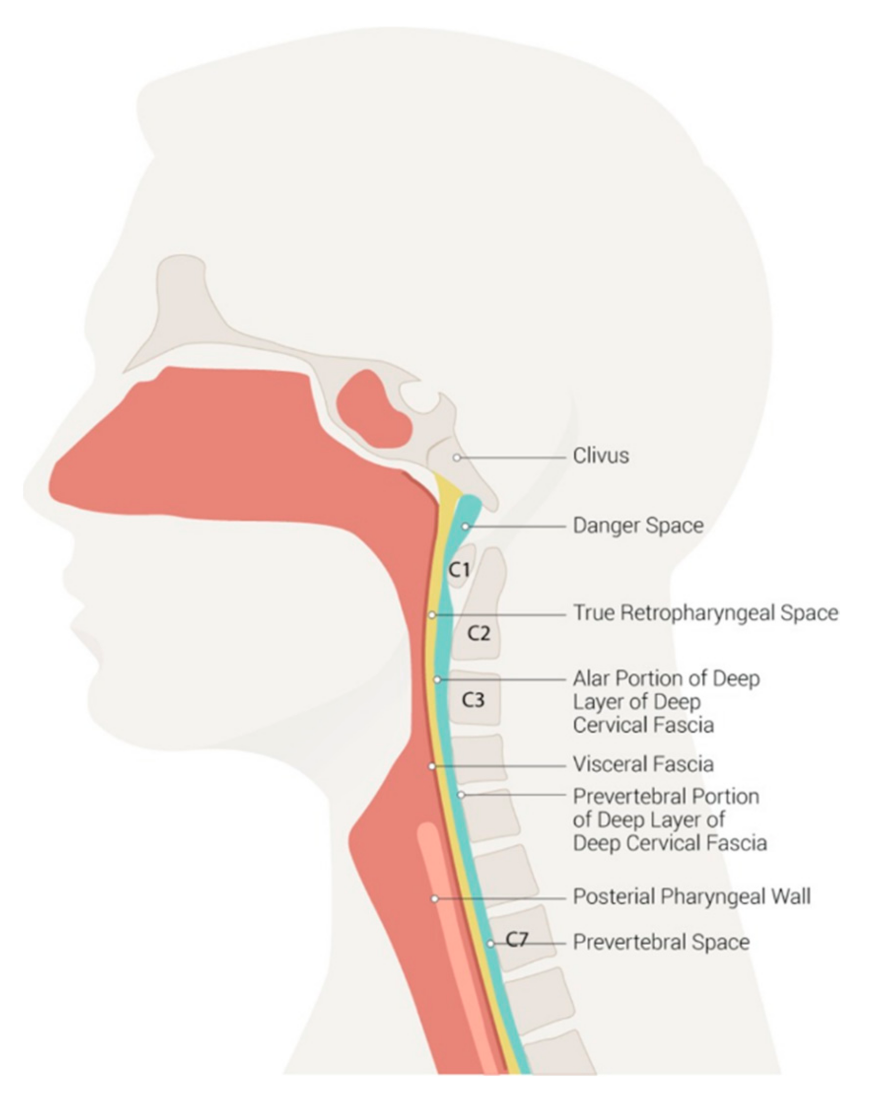 Parapharyngeal Space Abscess
