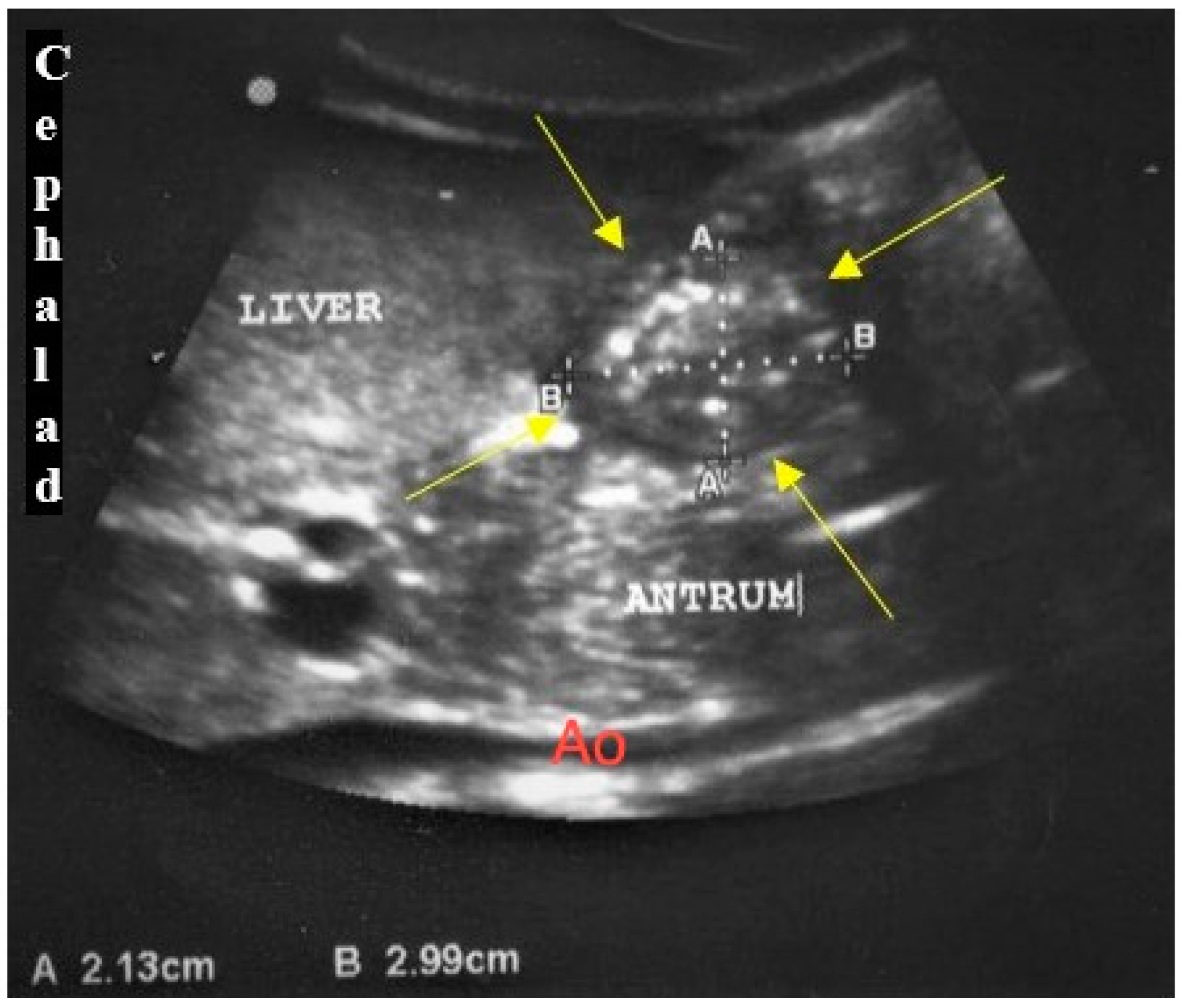 Children 09 00639 g001 550