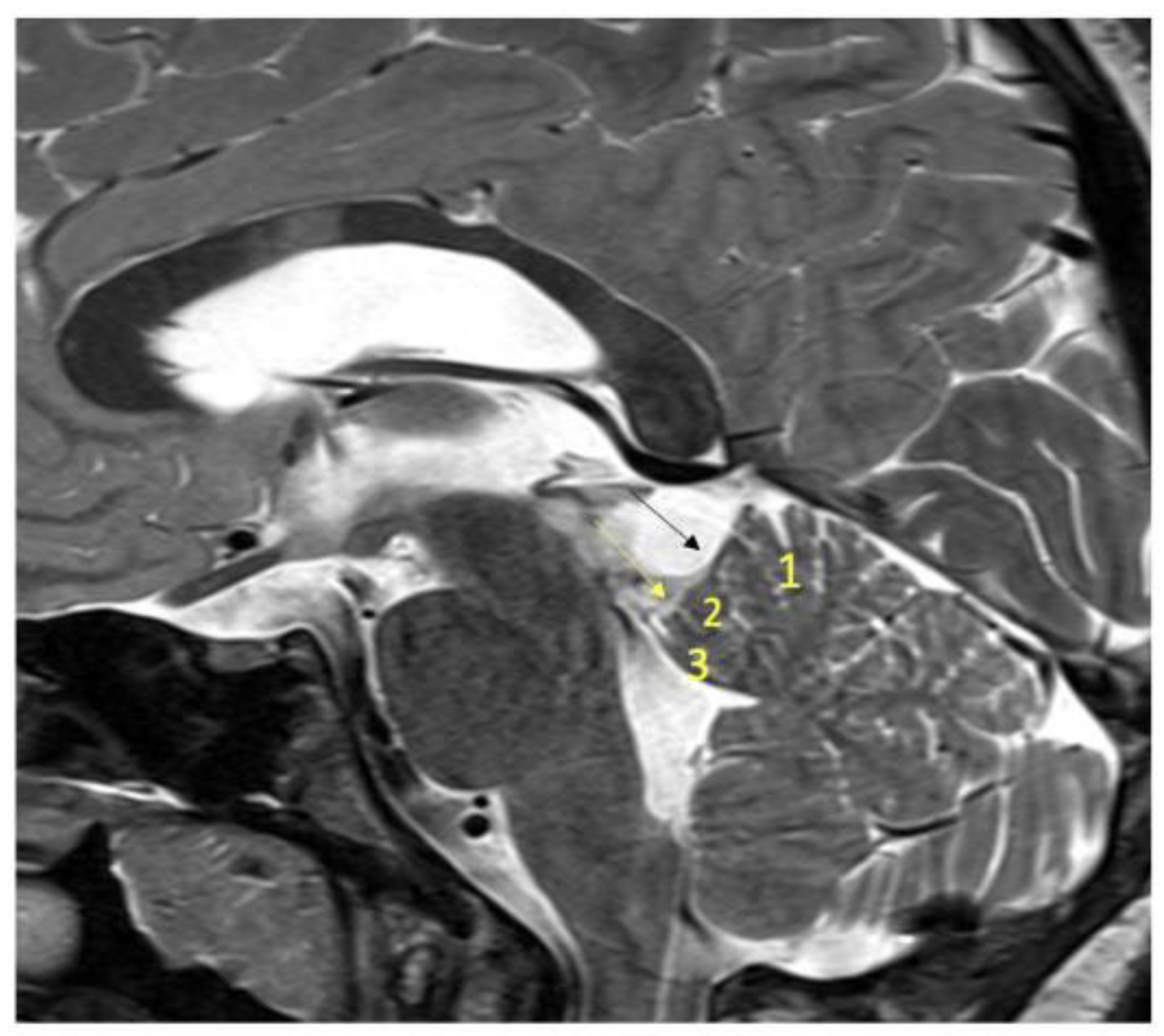 Children 09 00640 g004 550