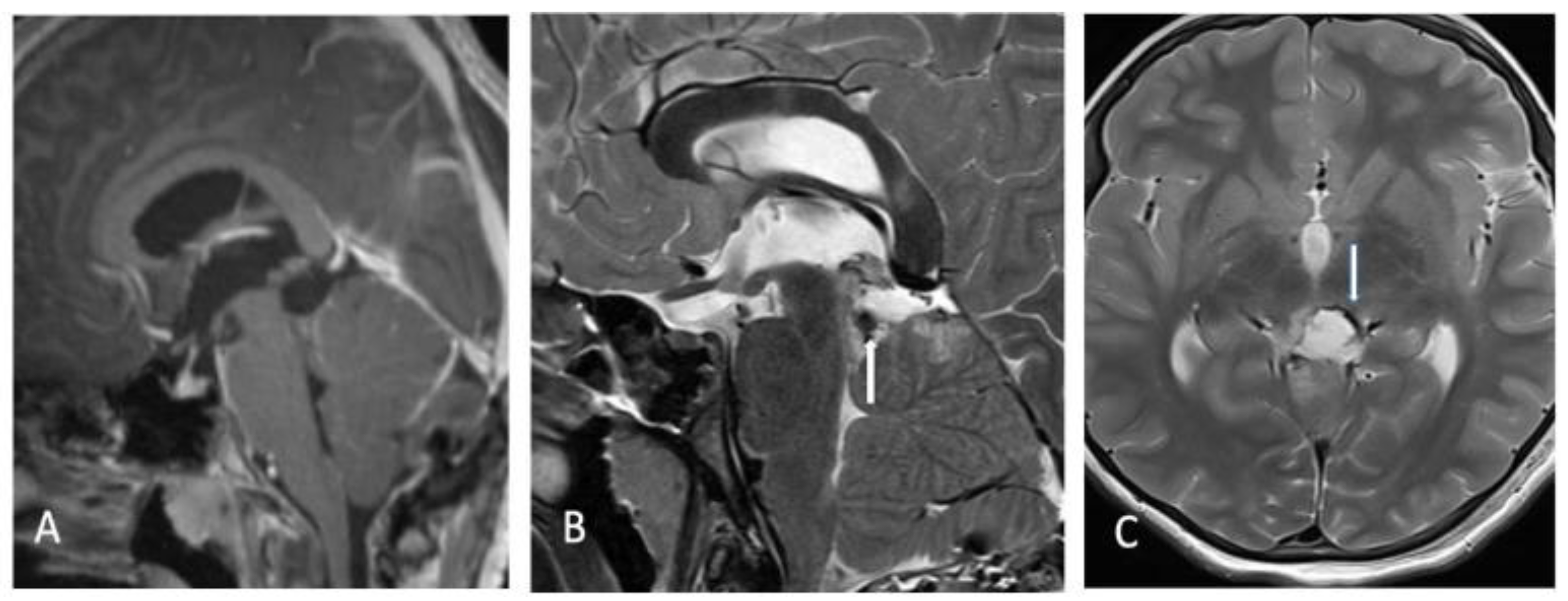 Children 09 00640 g005 550