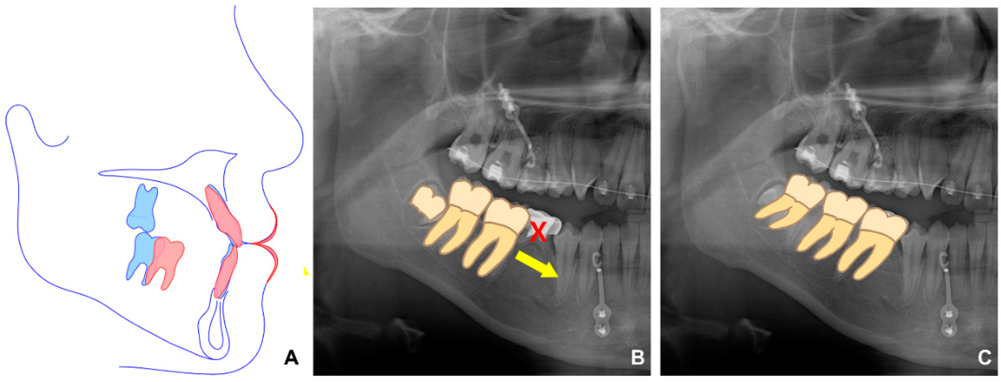 Children 09 00683 g004 550