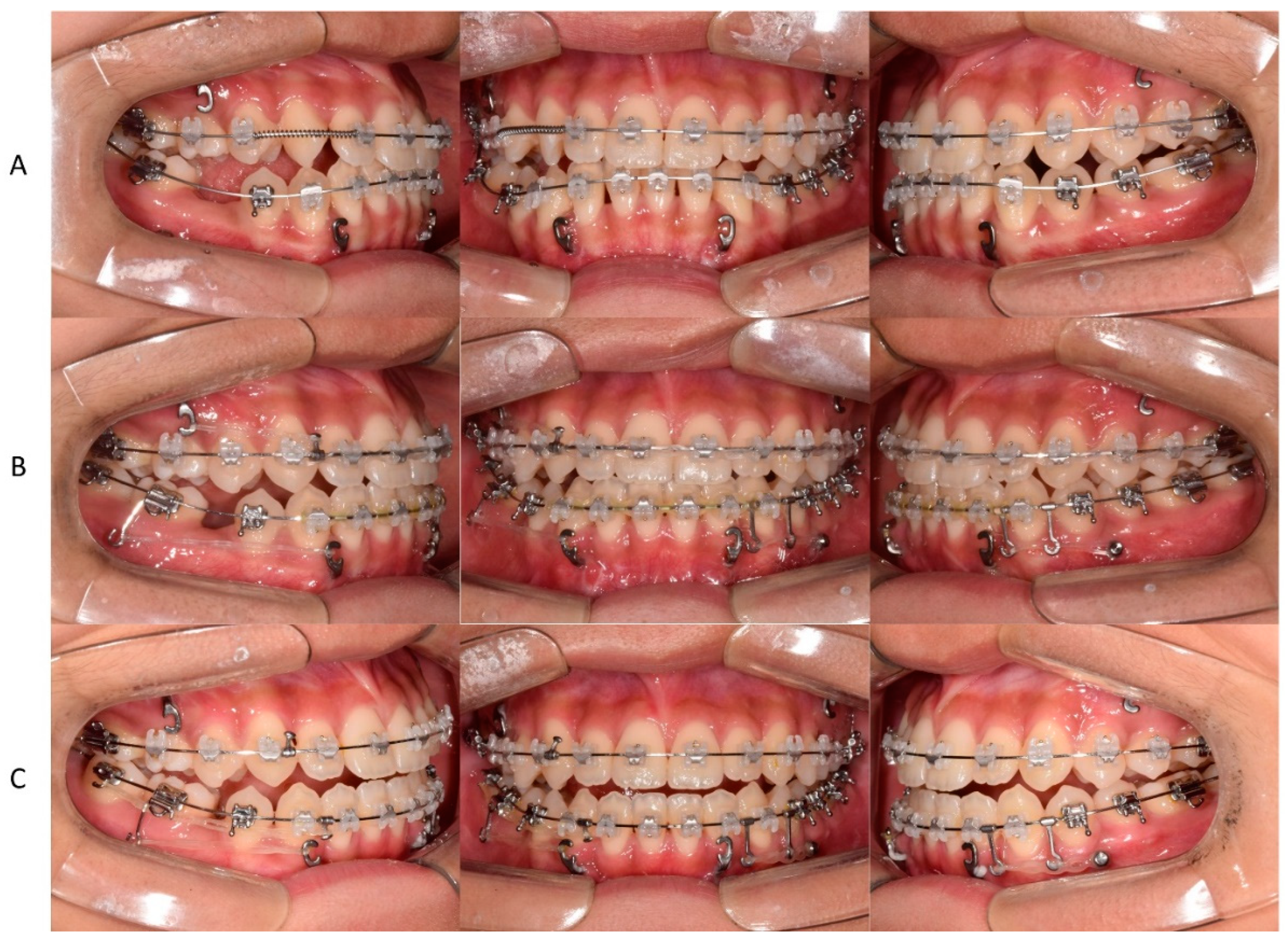 Children 09 00683 g005 550