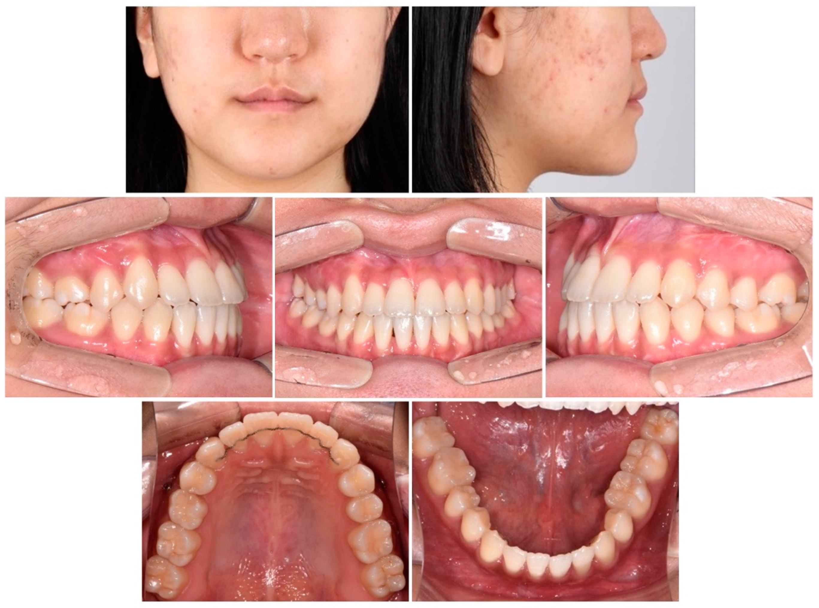 Children 09 00683 g006 550