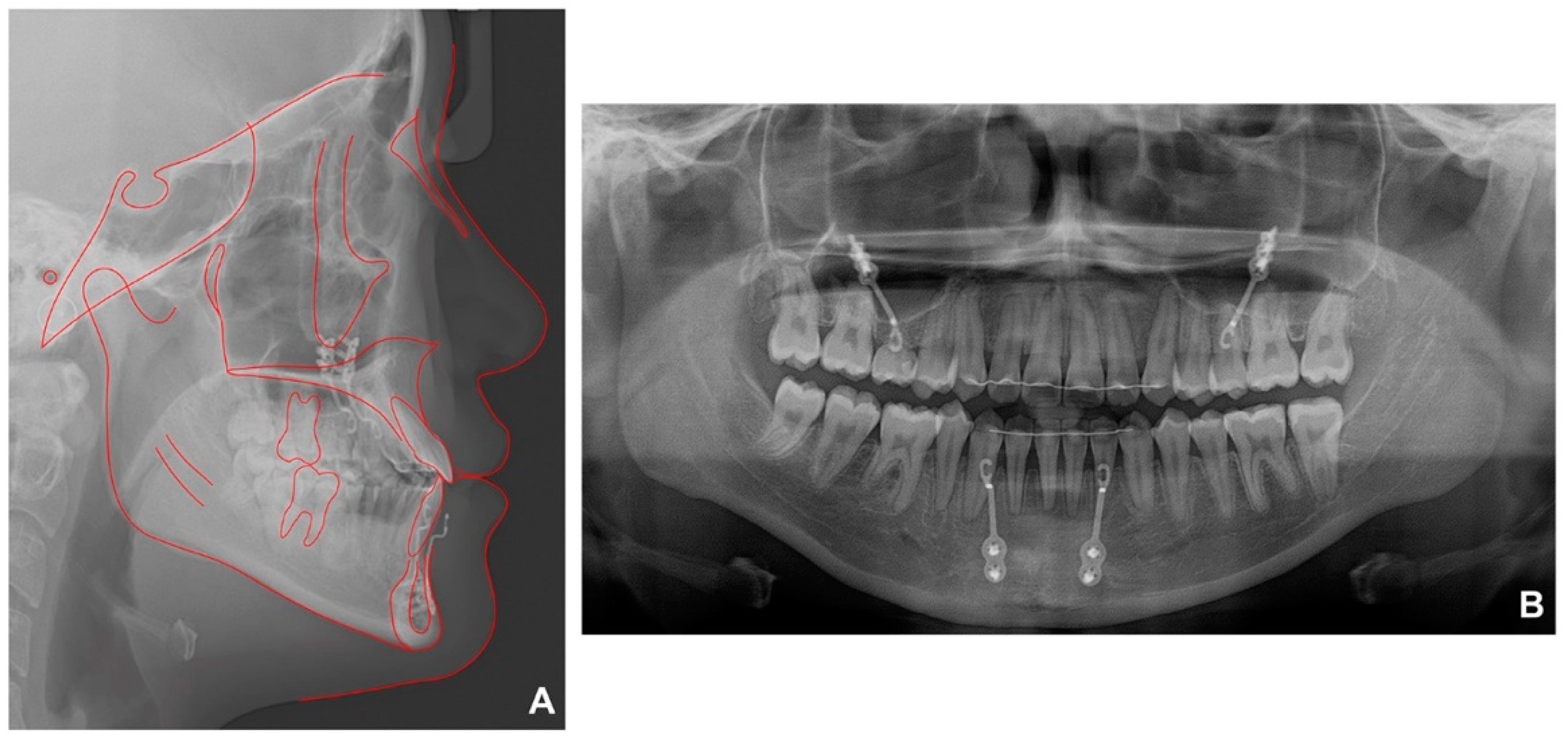 Children 09 00683 g007 550