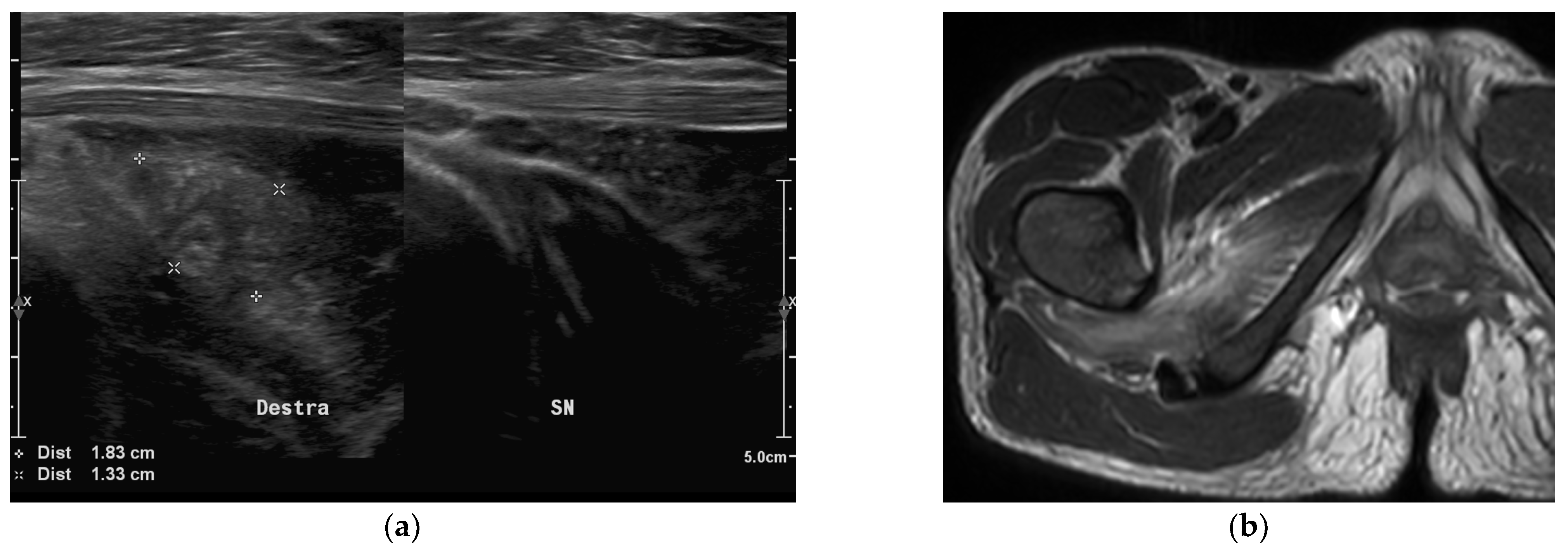 Children 09 00685 g002 Children 09 00685 g002