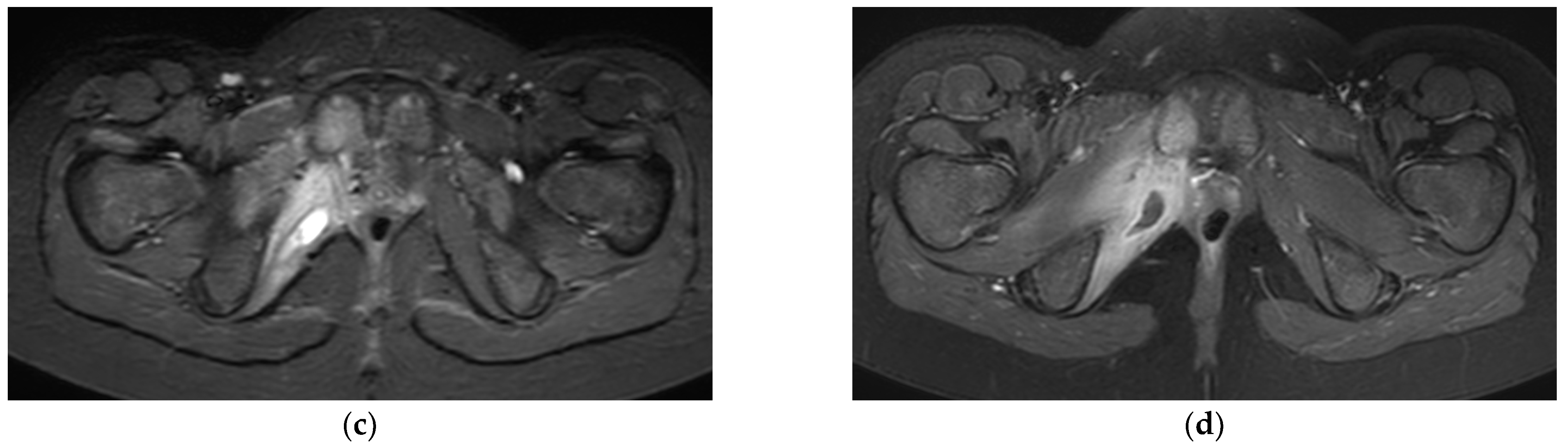 Children 09 00685 g003b Children 09 00685 g003b