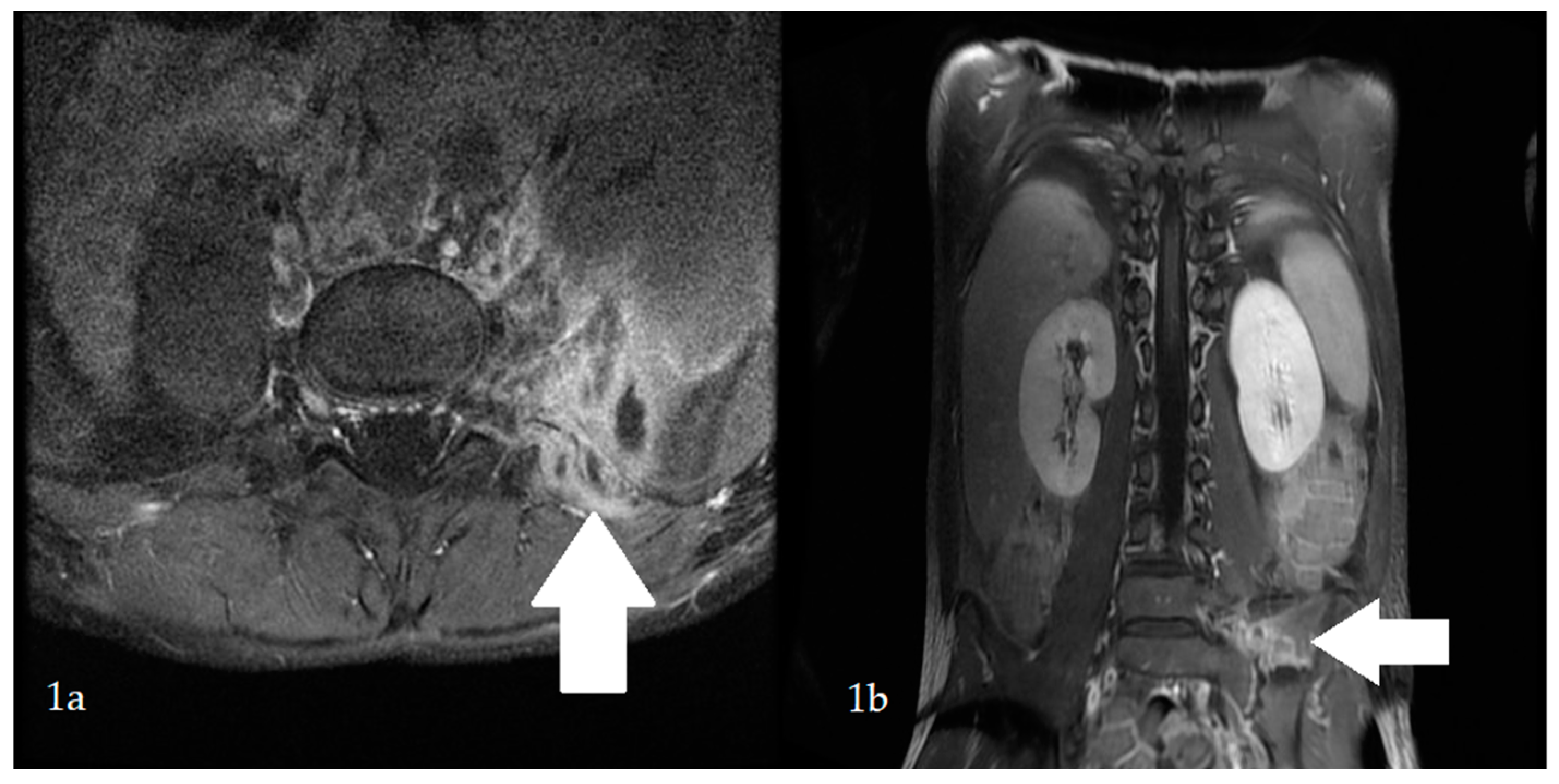 Children 09 00726 g001 550