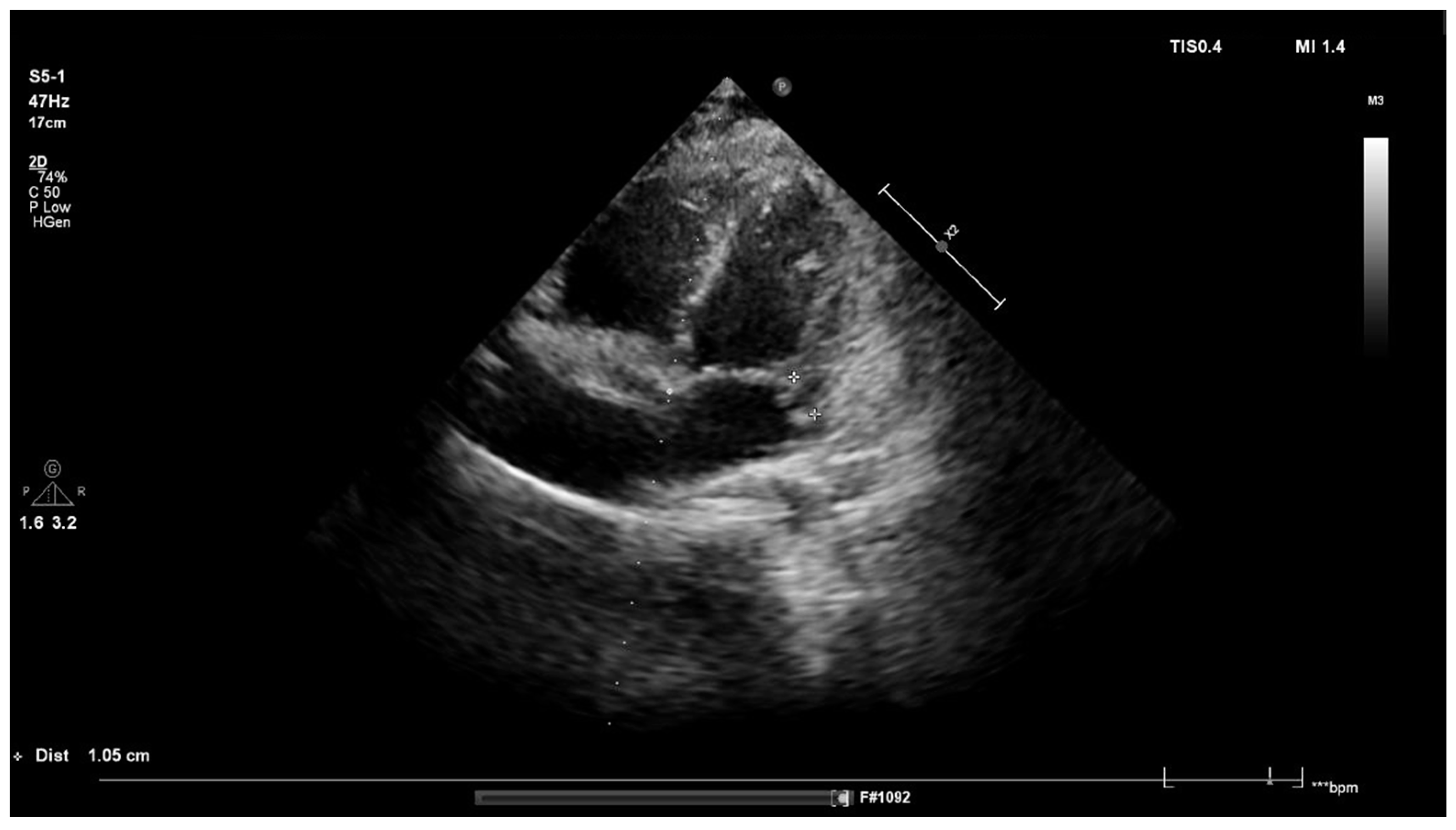 Children 09 00726 g002 550