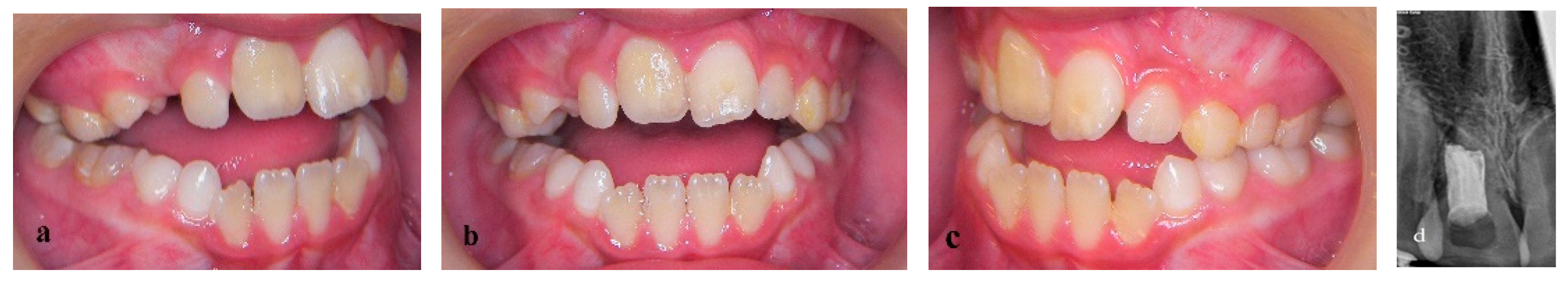 Children 09 00732 g002 550