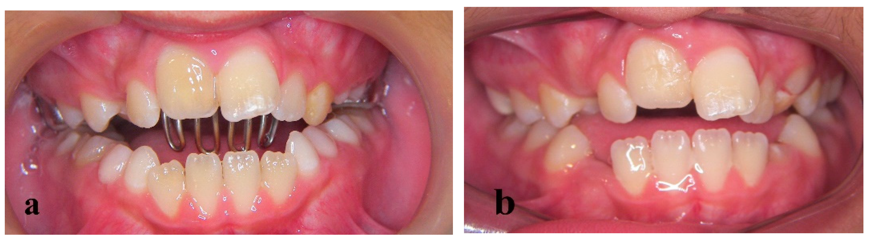 Children 09 00732 g003 550