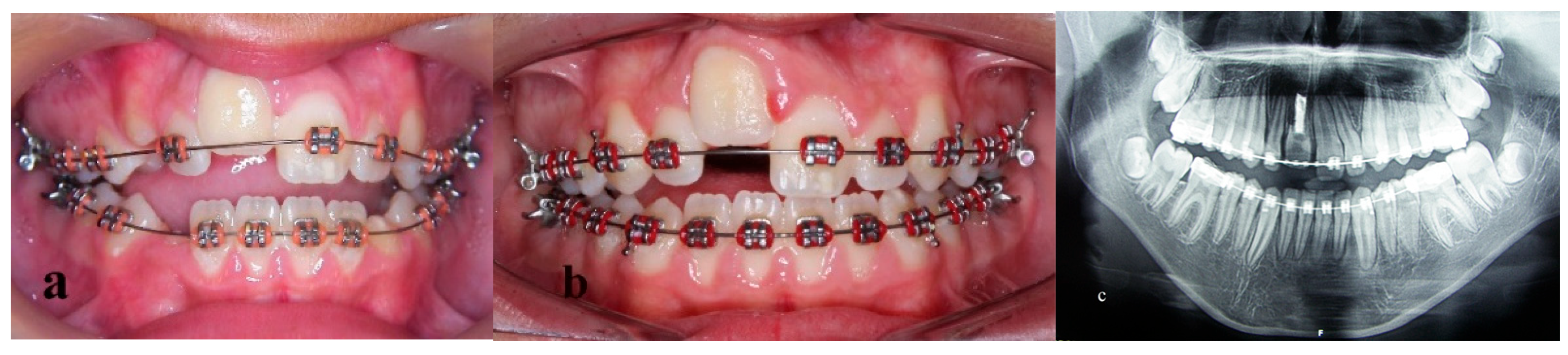 Children 09 00732 g004 550