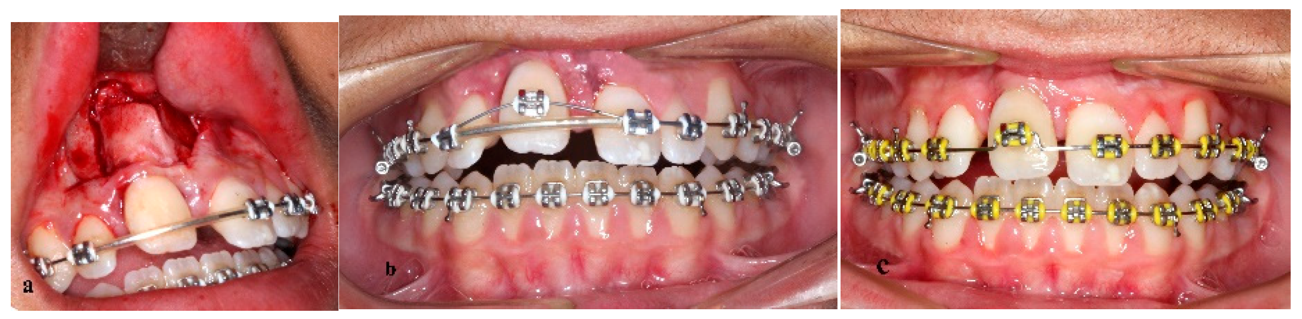 Children 09 00732 g005 550