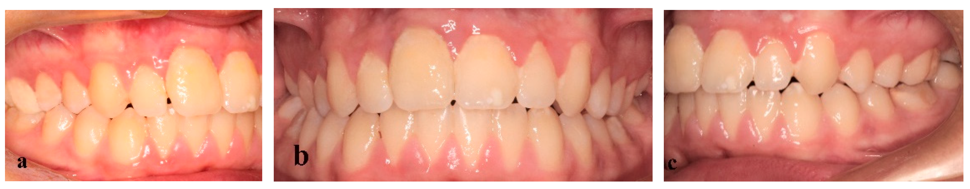 Children 09 00732 g006 550