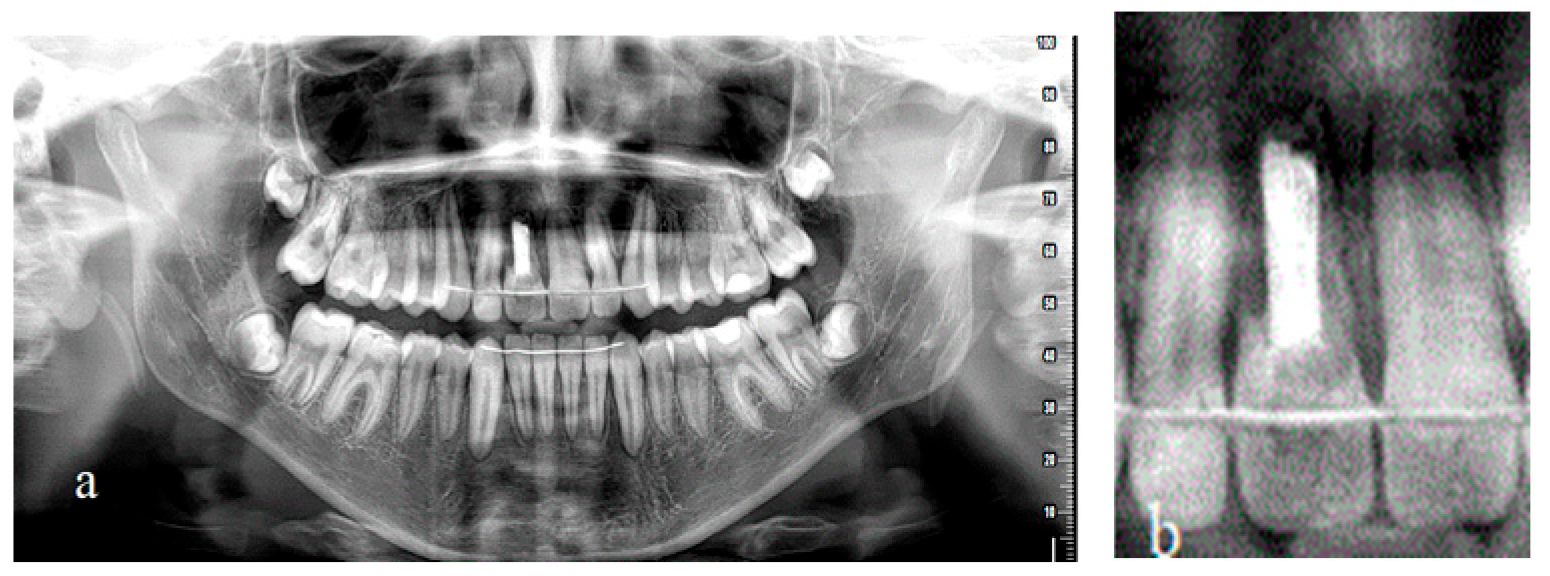 Children 09 00732 g007 550