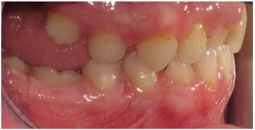 Children 09 00771 g005