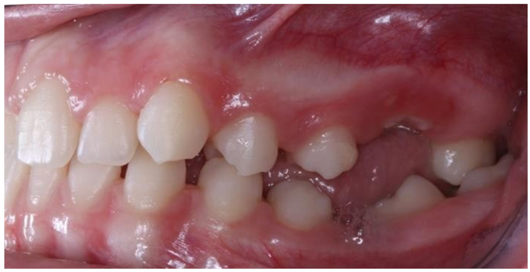 Children 09 00771 g006