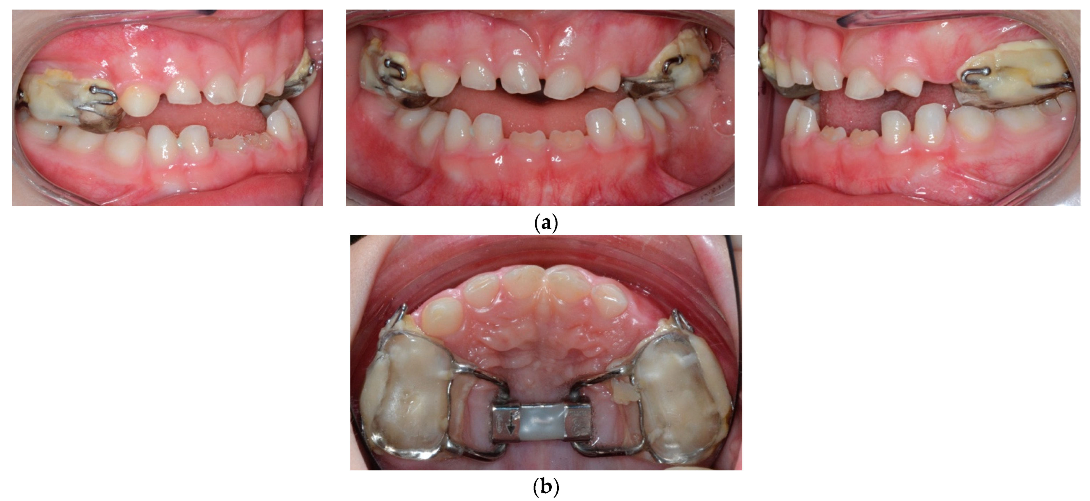 Children 09 00784 g003