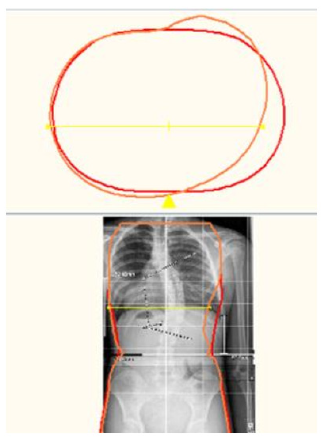 Children 09 00842 g006 550