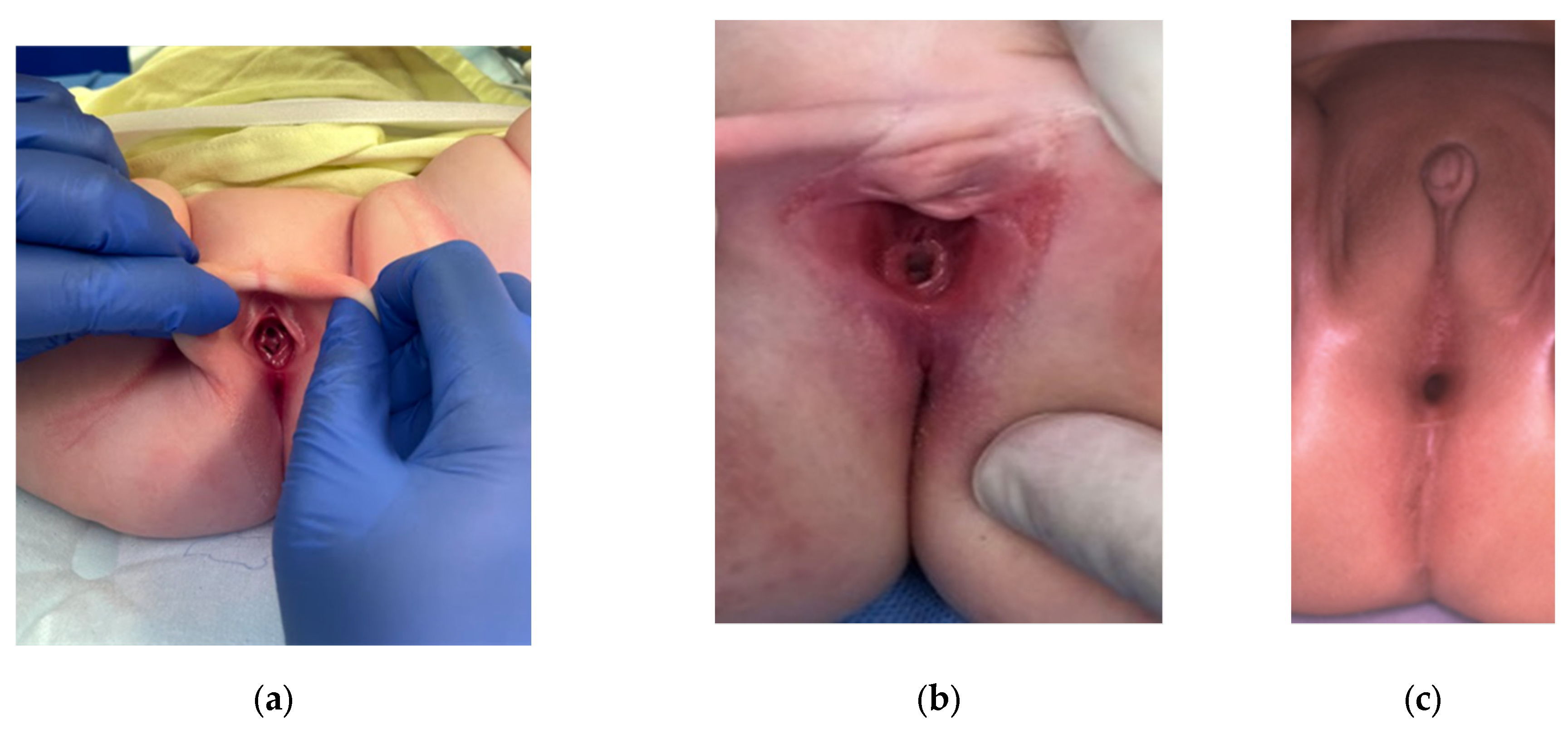 Children 09 00888 g004 550