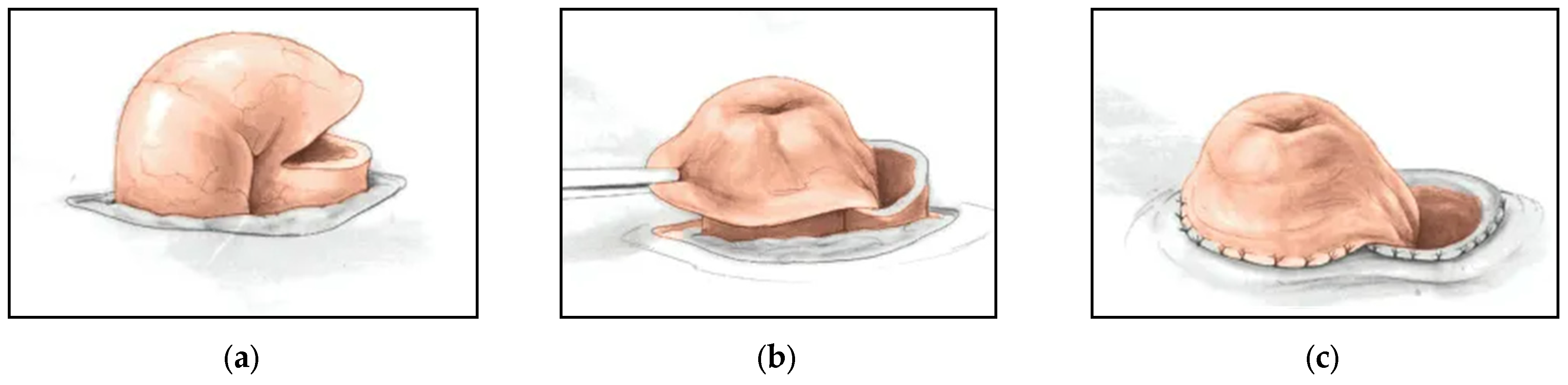 Children 09 00888 g007 550