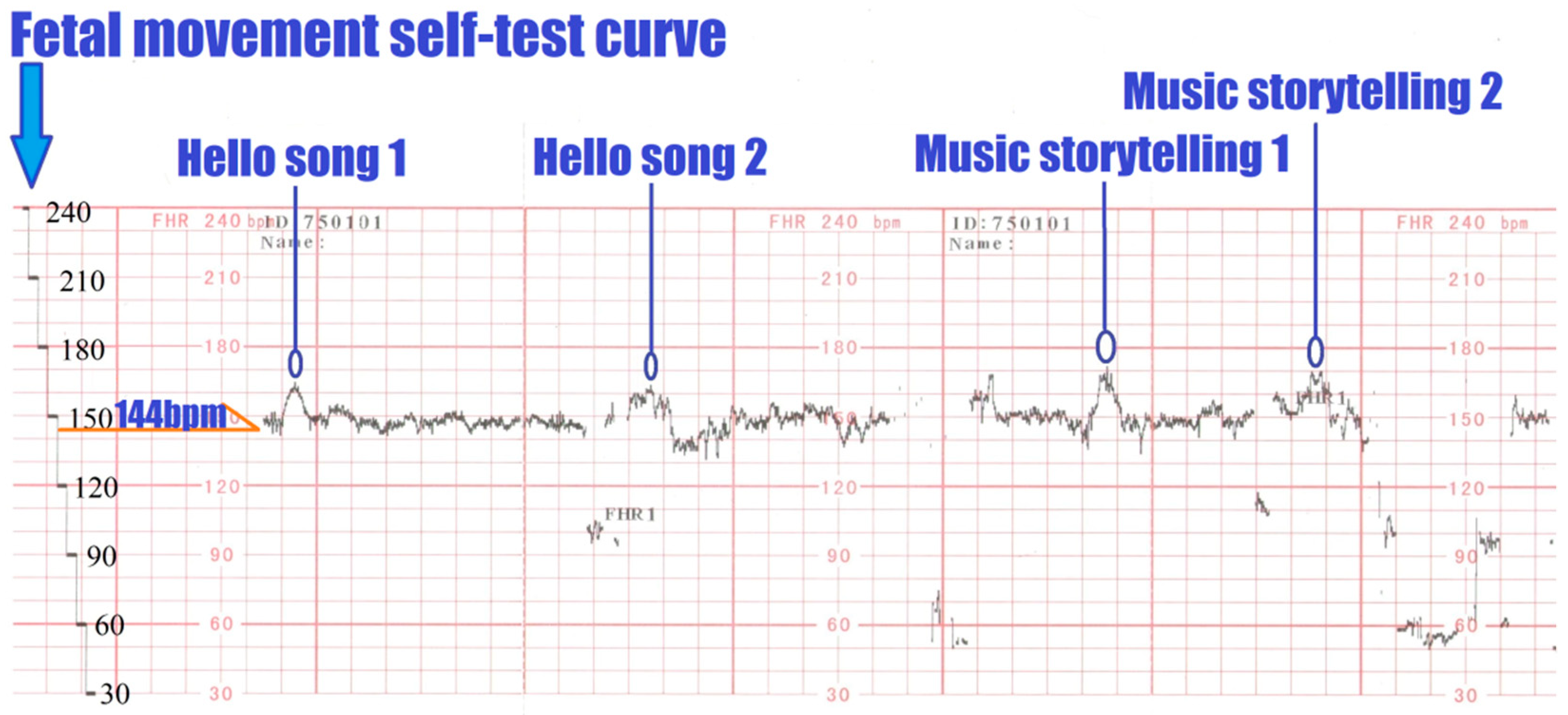 Children 09 00918 g004 550