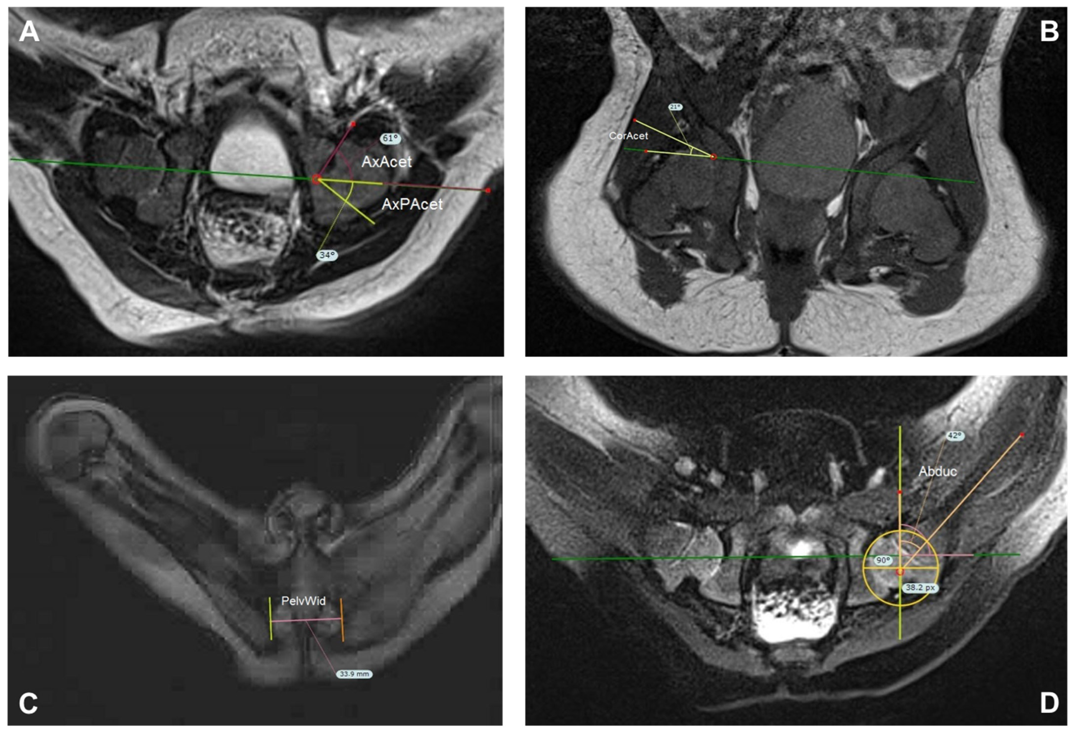 Children 09 01010 g004 550