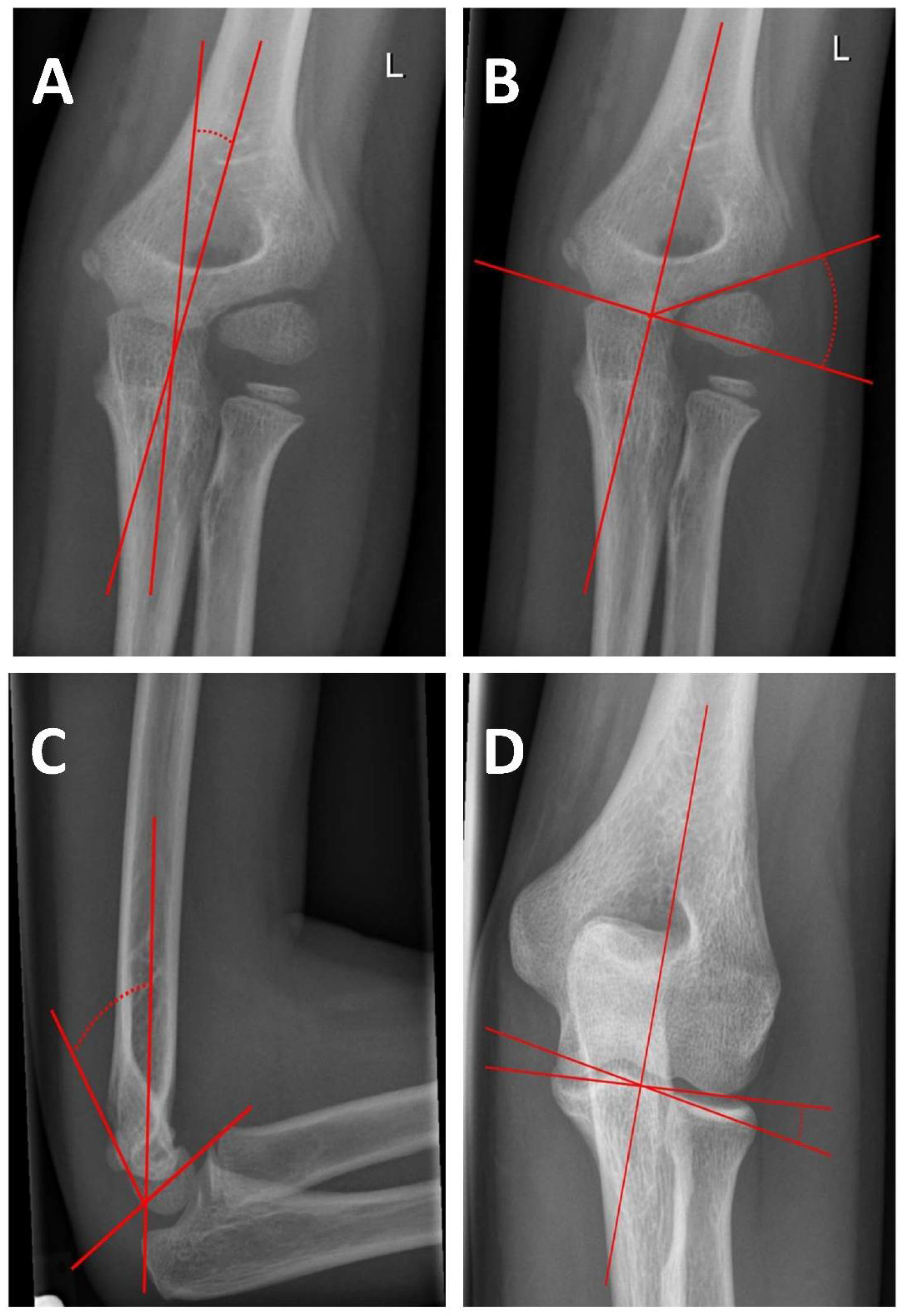 Children 09 01013 g002