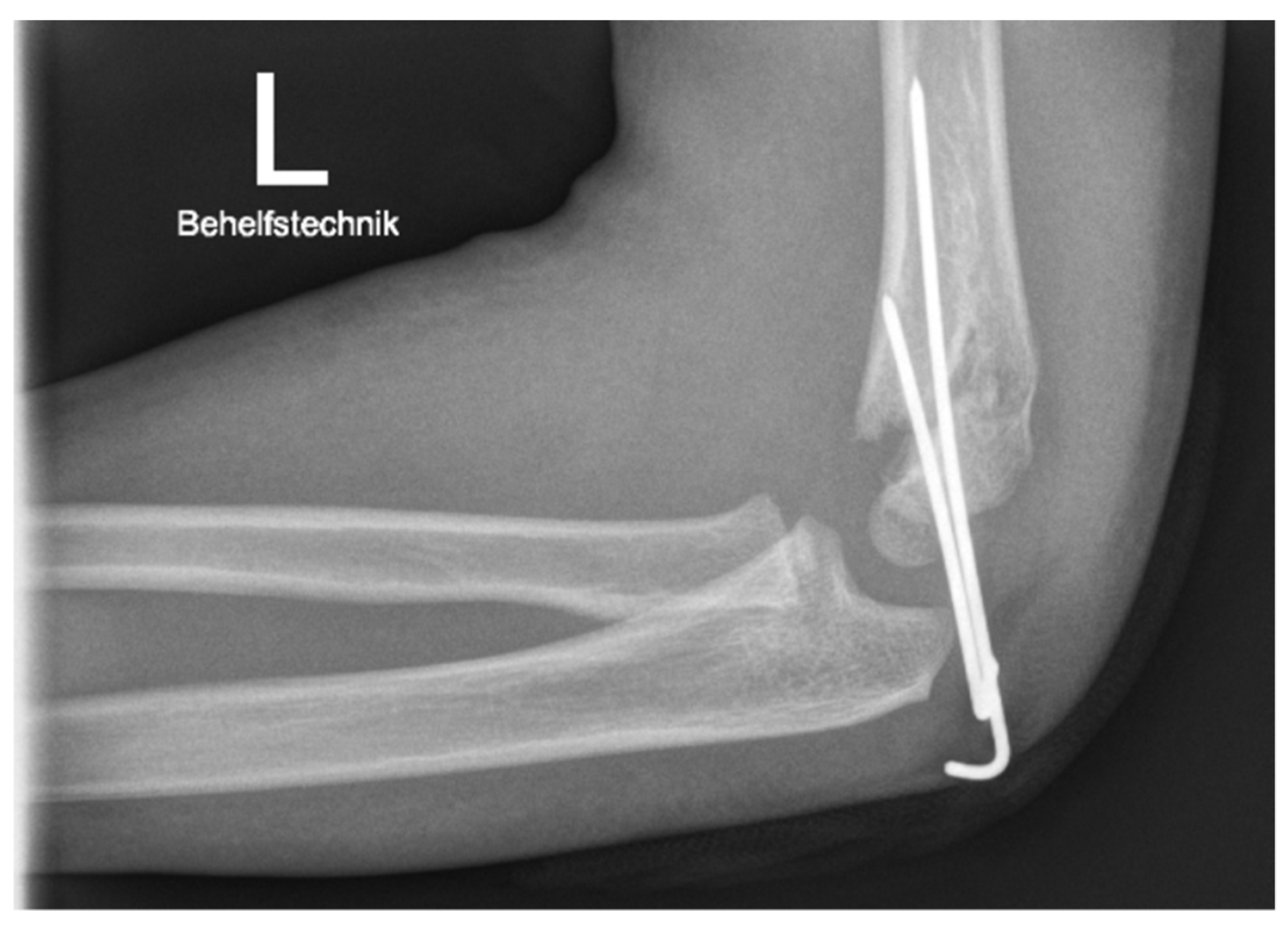 Children 09 01013 g003