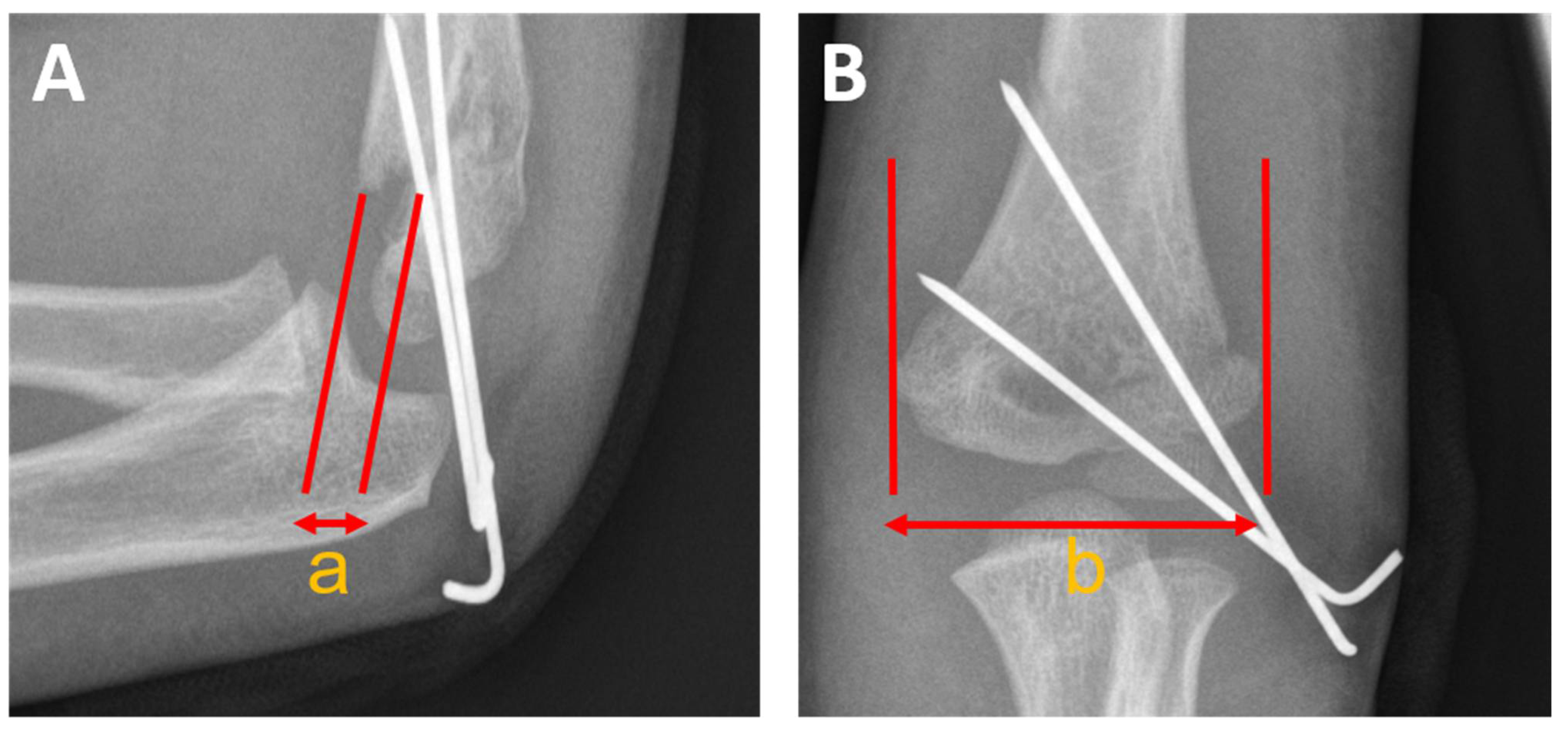 Children 09 01013 g004