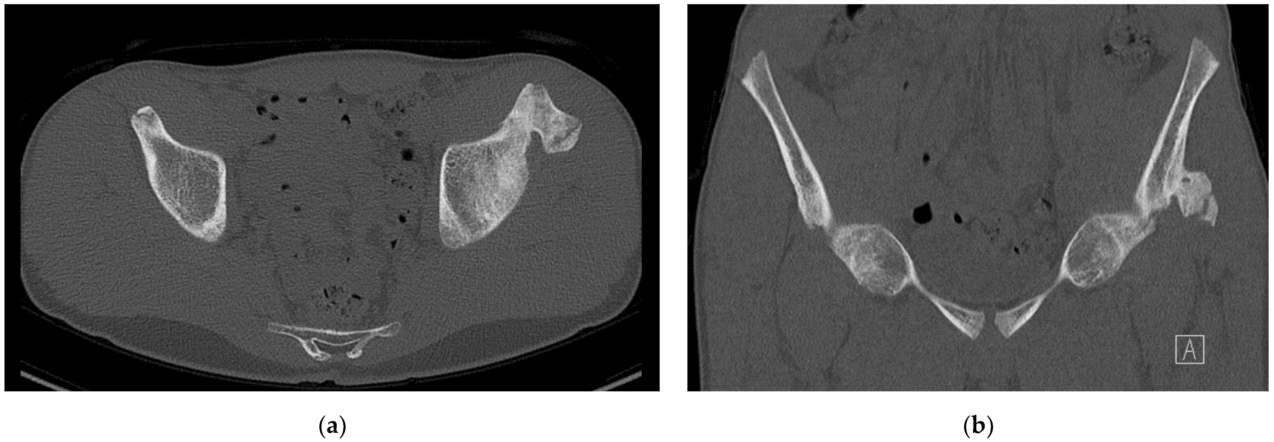 Children 09 01016 g002