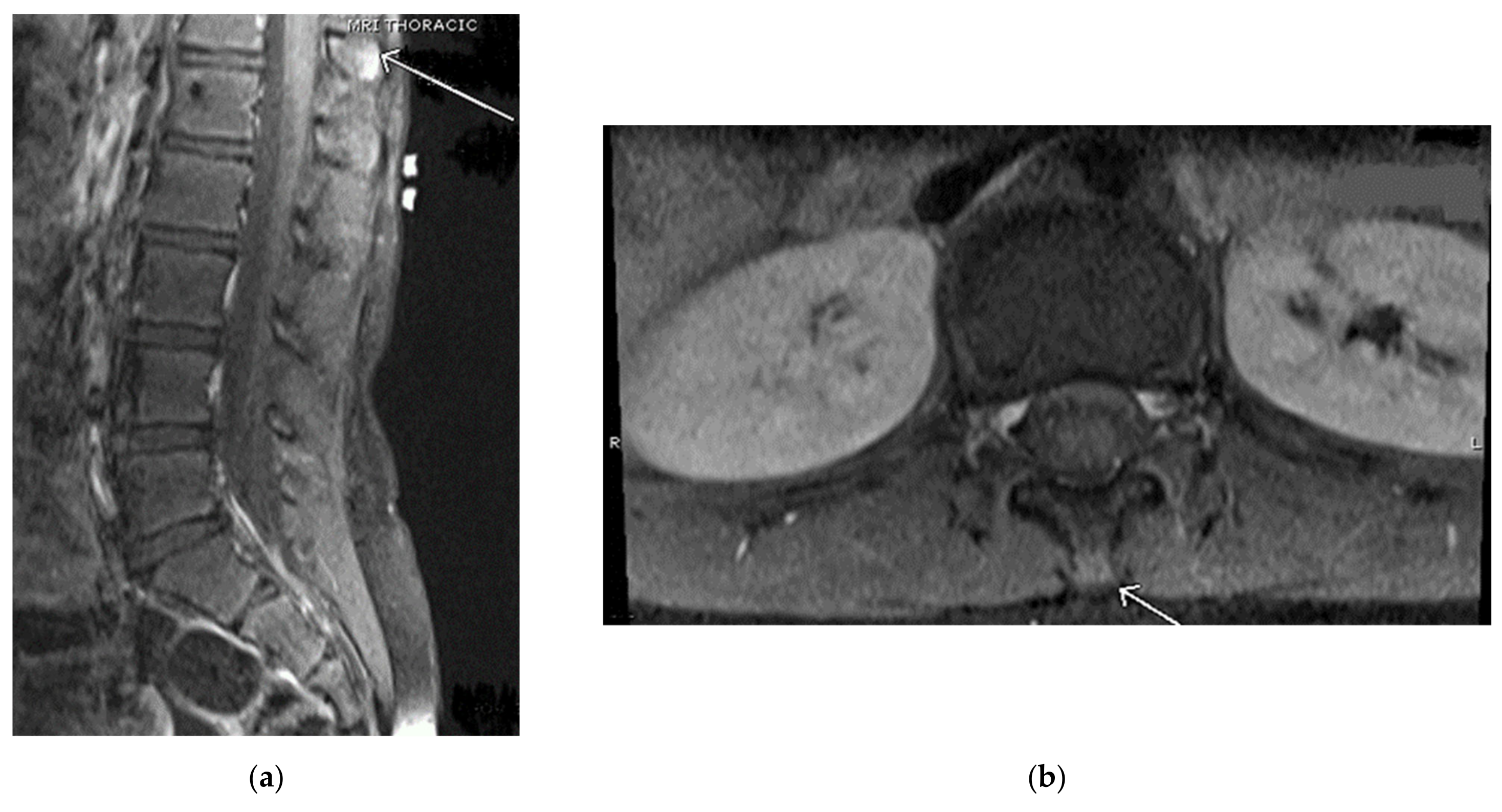 Children 09 01018 g001