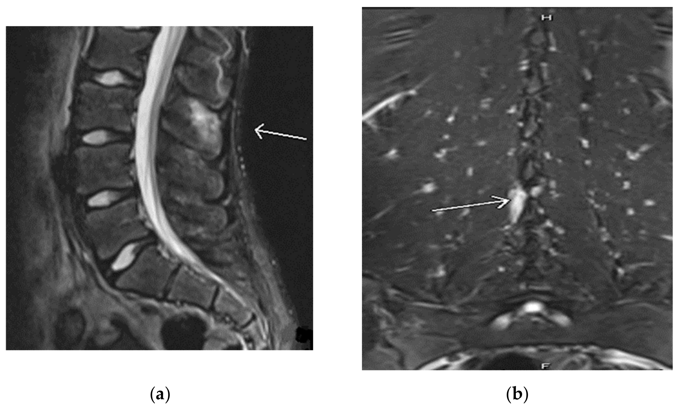 Children 09 01018 g002