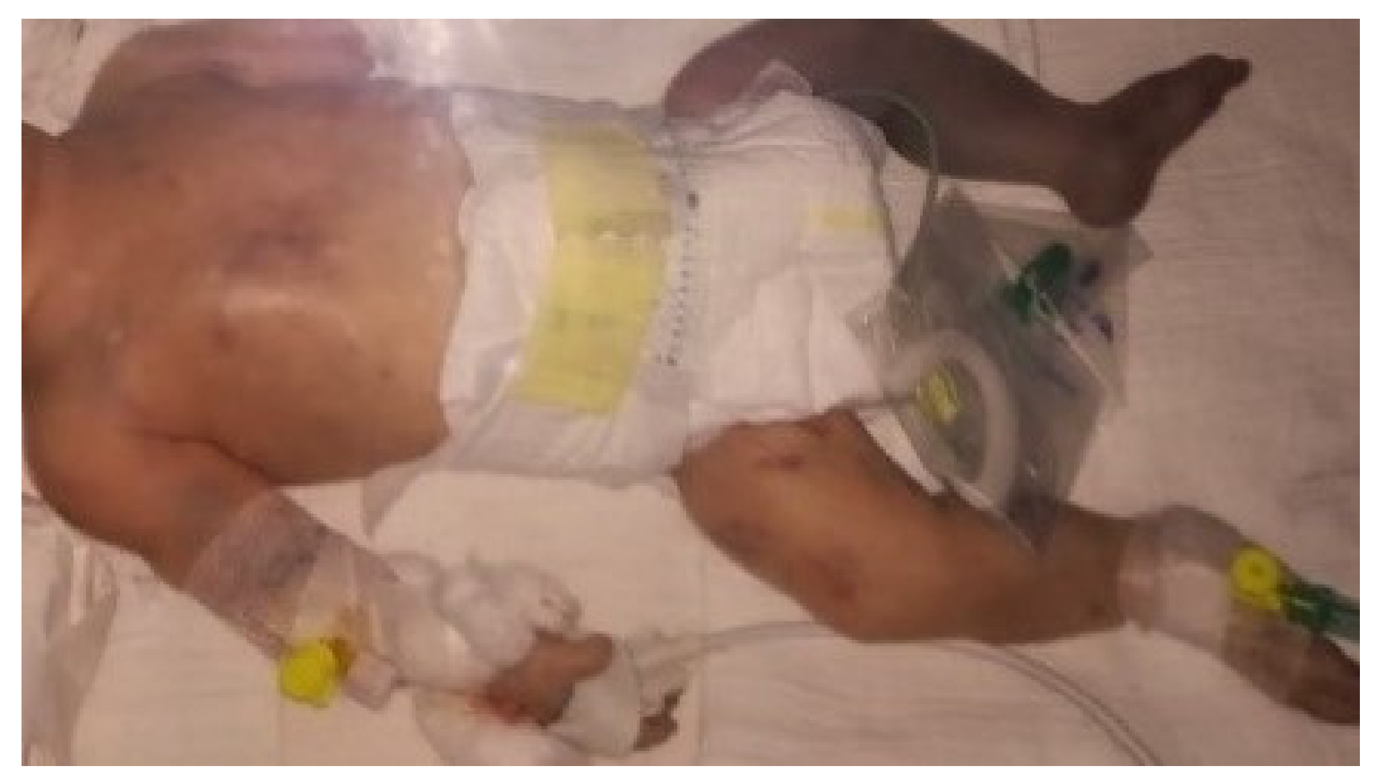 Children 09 01020 g001