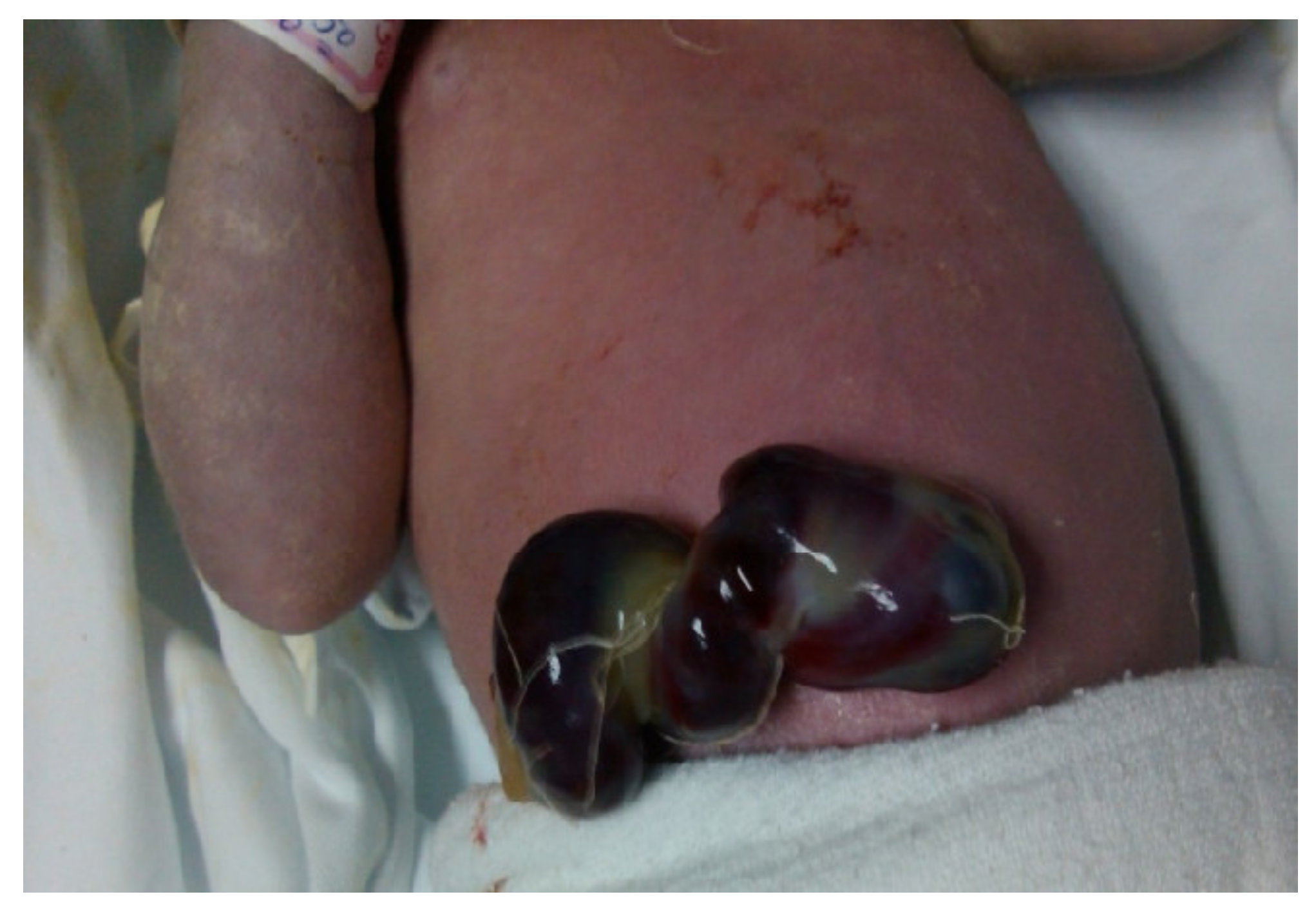 Children 09 01020 g003