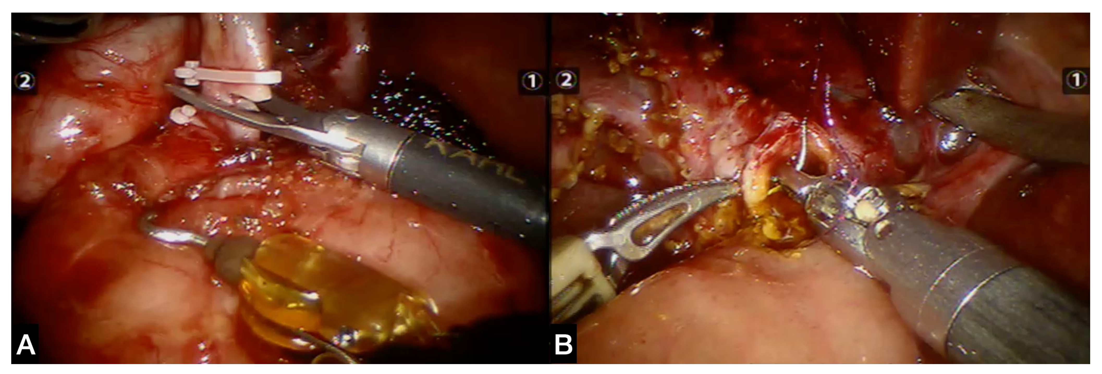 Children 09 01021 g003 550