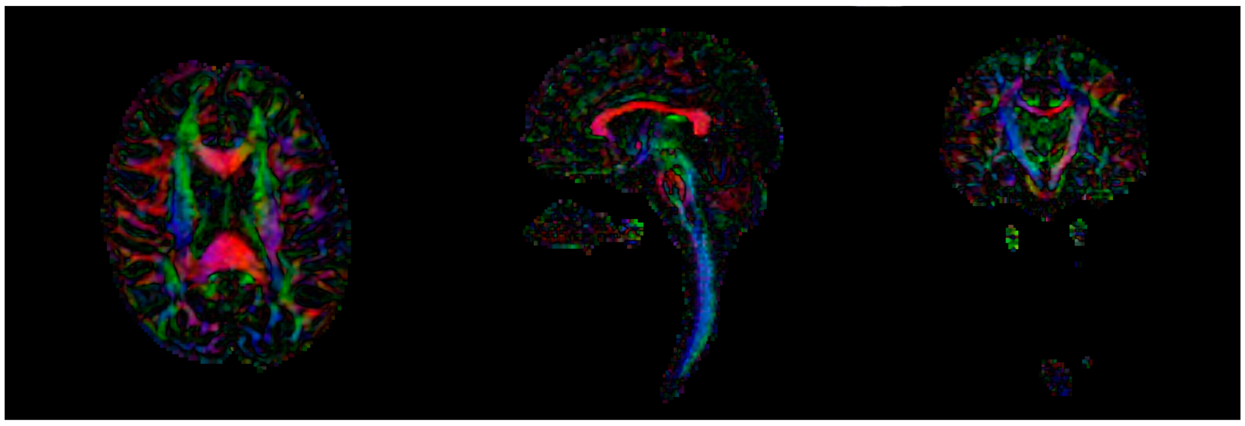 Children 09 01023 g002 Children 09 01023 g002