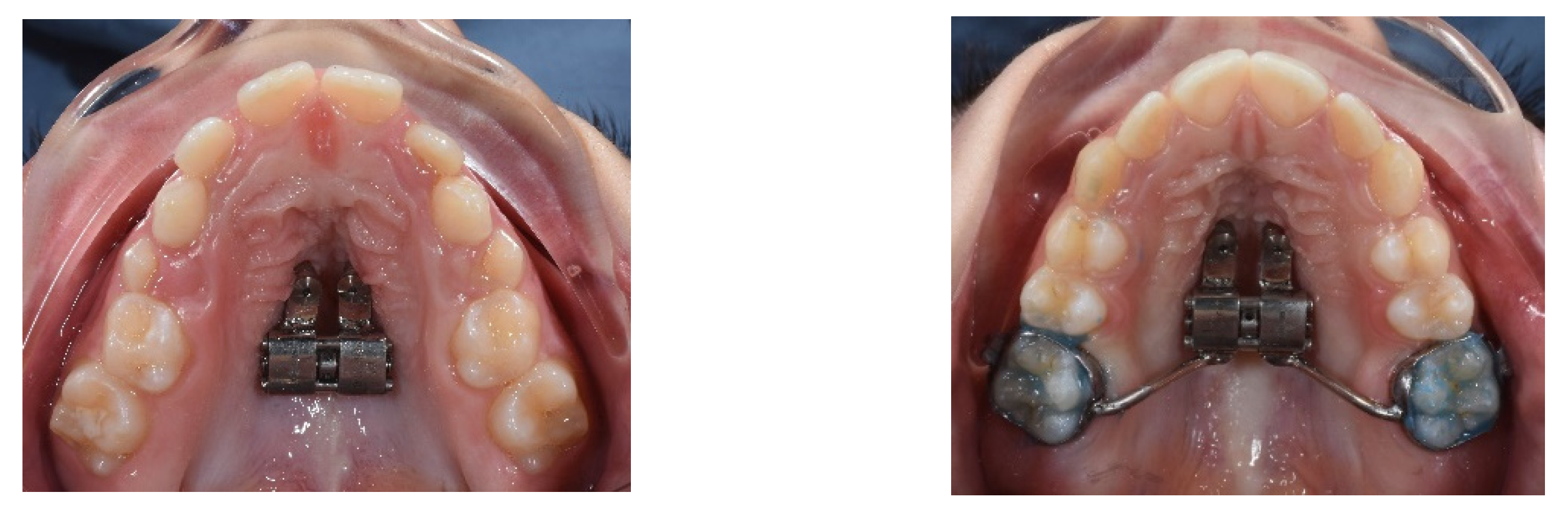 Children 09 01046 g002 Children 09 01046 g002