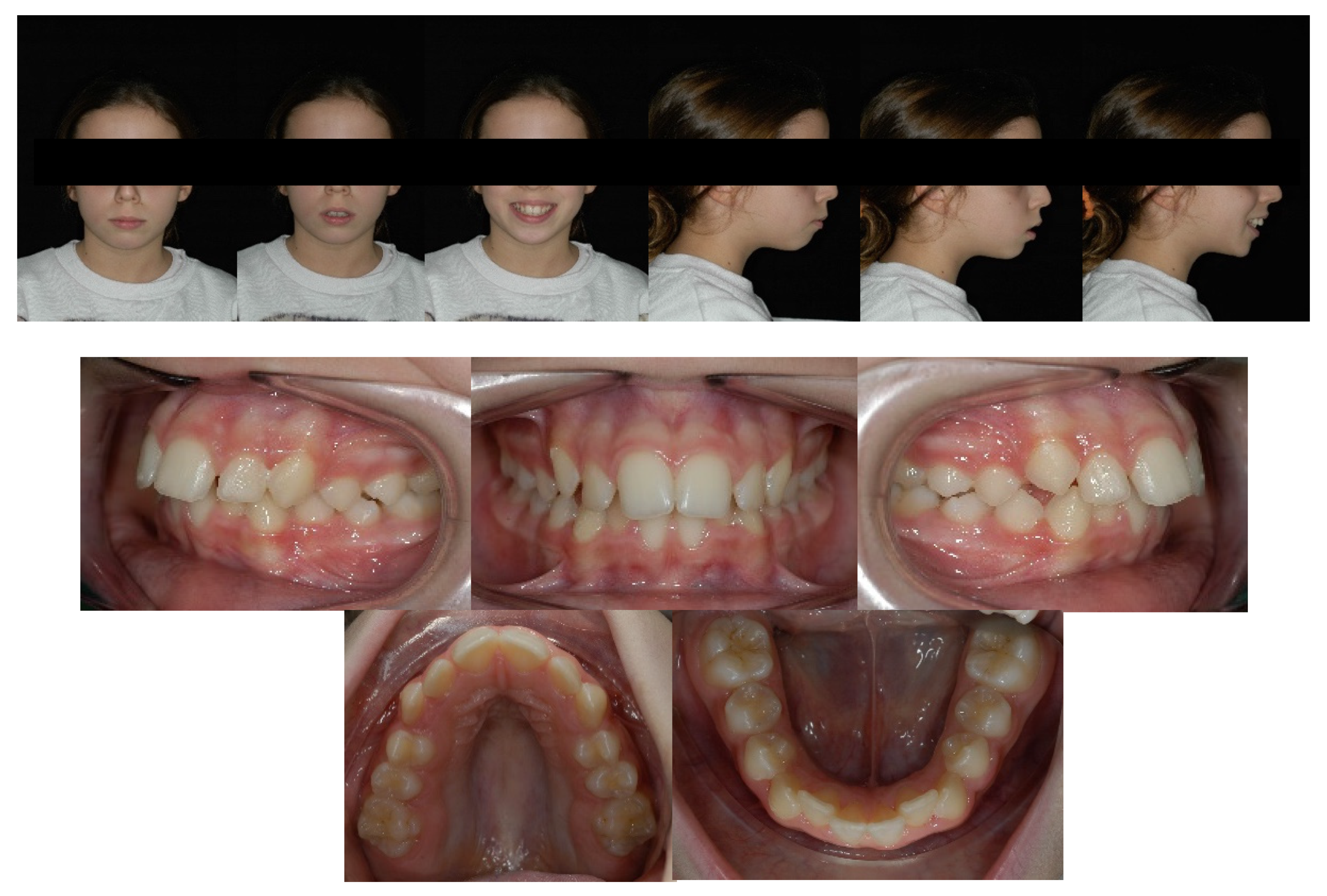 Children 09 01046 g004 Children 09 01046 g004