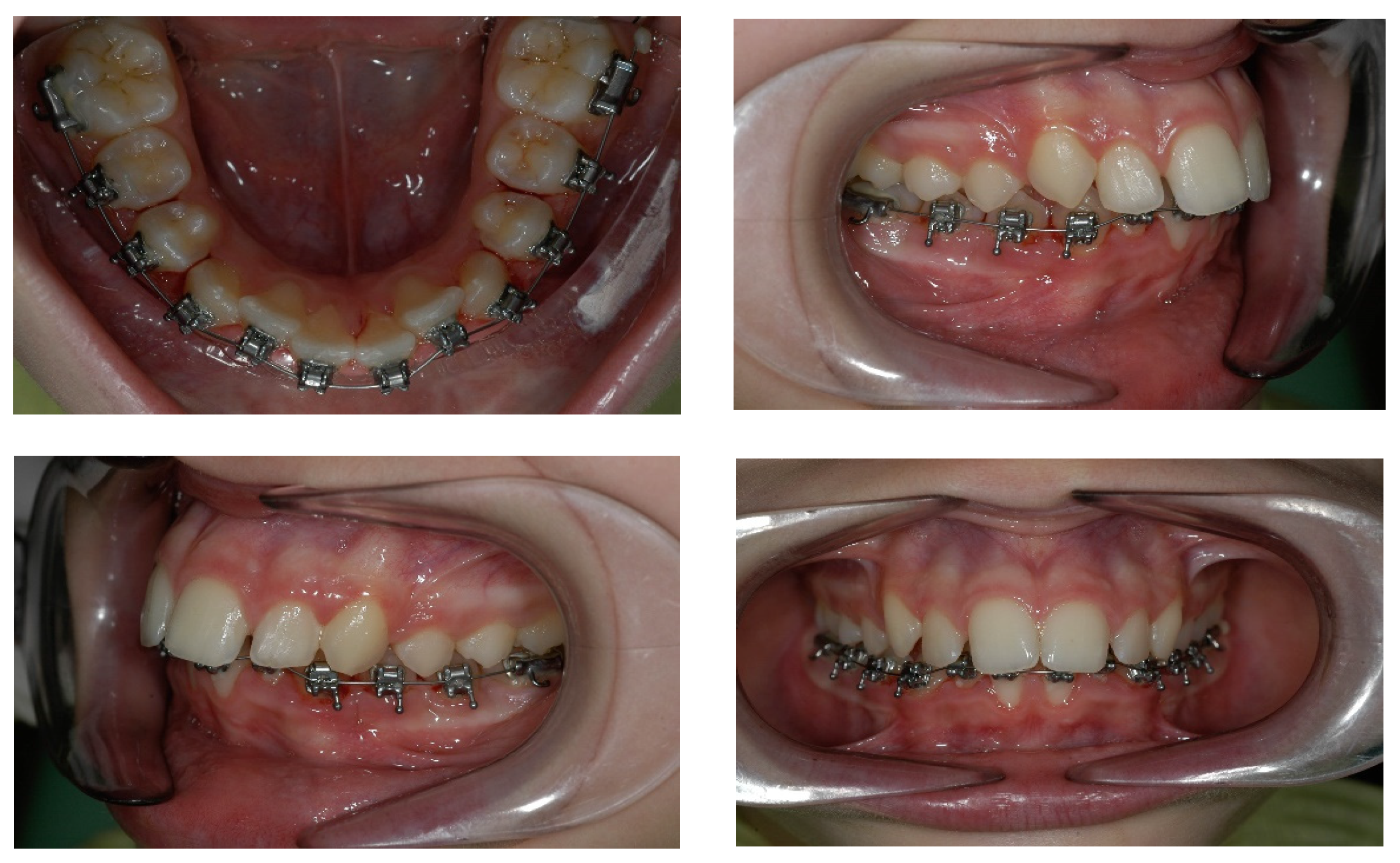 Children 09 01046 g008 Children 09 01046 g008