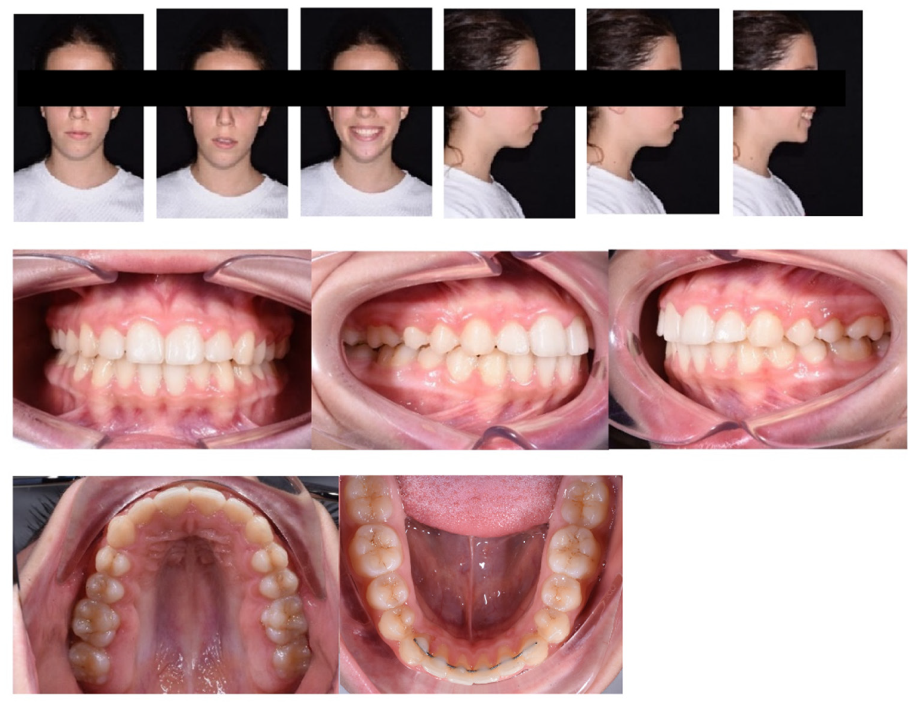 Children 09 01046 g012 Children 09 01046 g012