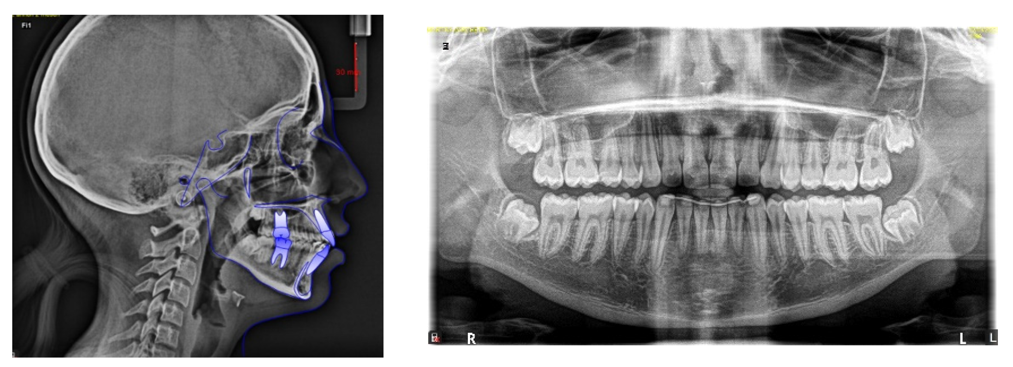 Children 09 01046 g015 Children 09 01046 g015