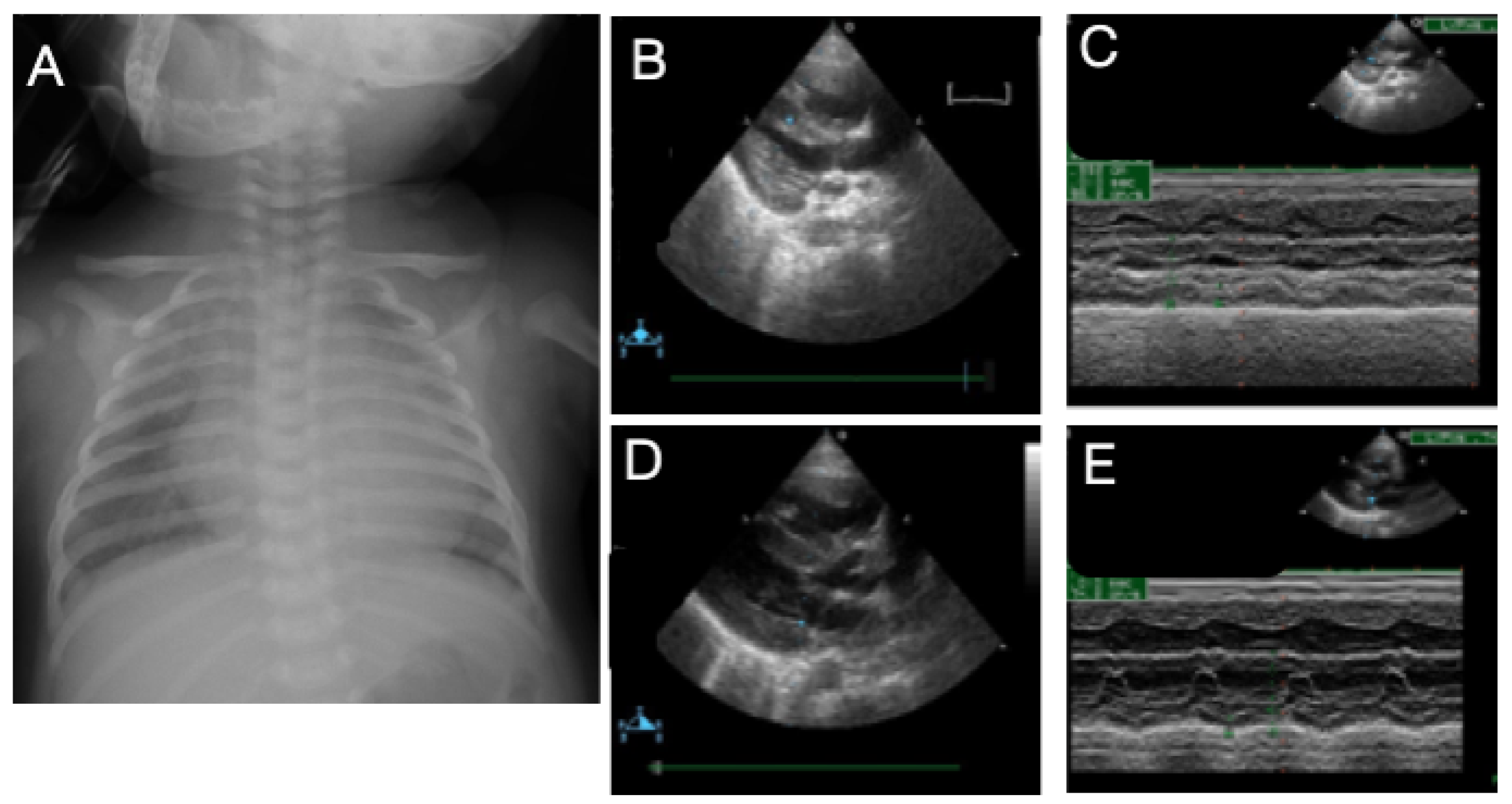 Children 09 01064 g004