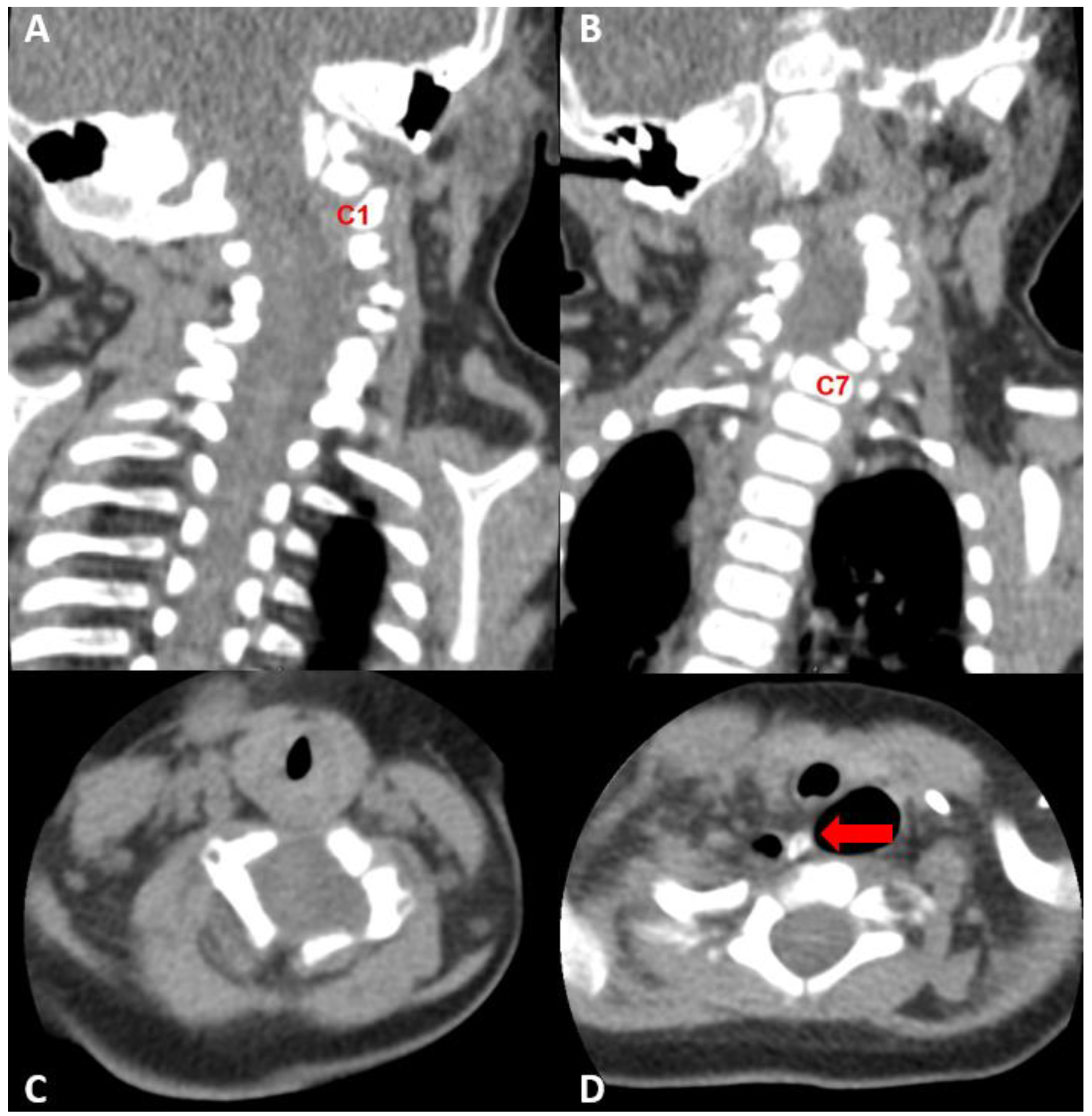 Children 09 01085 g002 Children 09 01085 g002