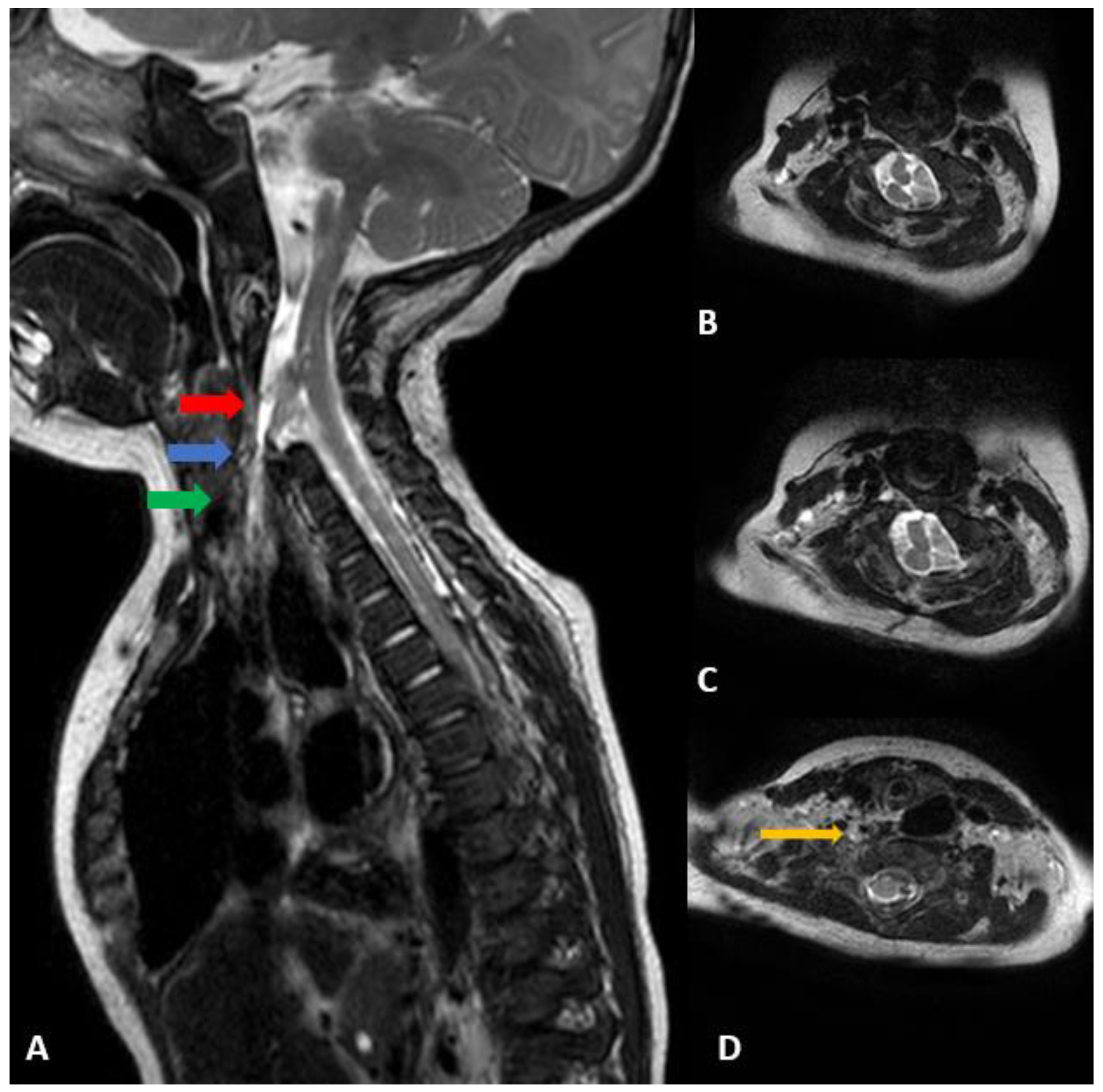 Children 09 01085 g003 Children 09 01085 g003