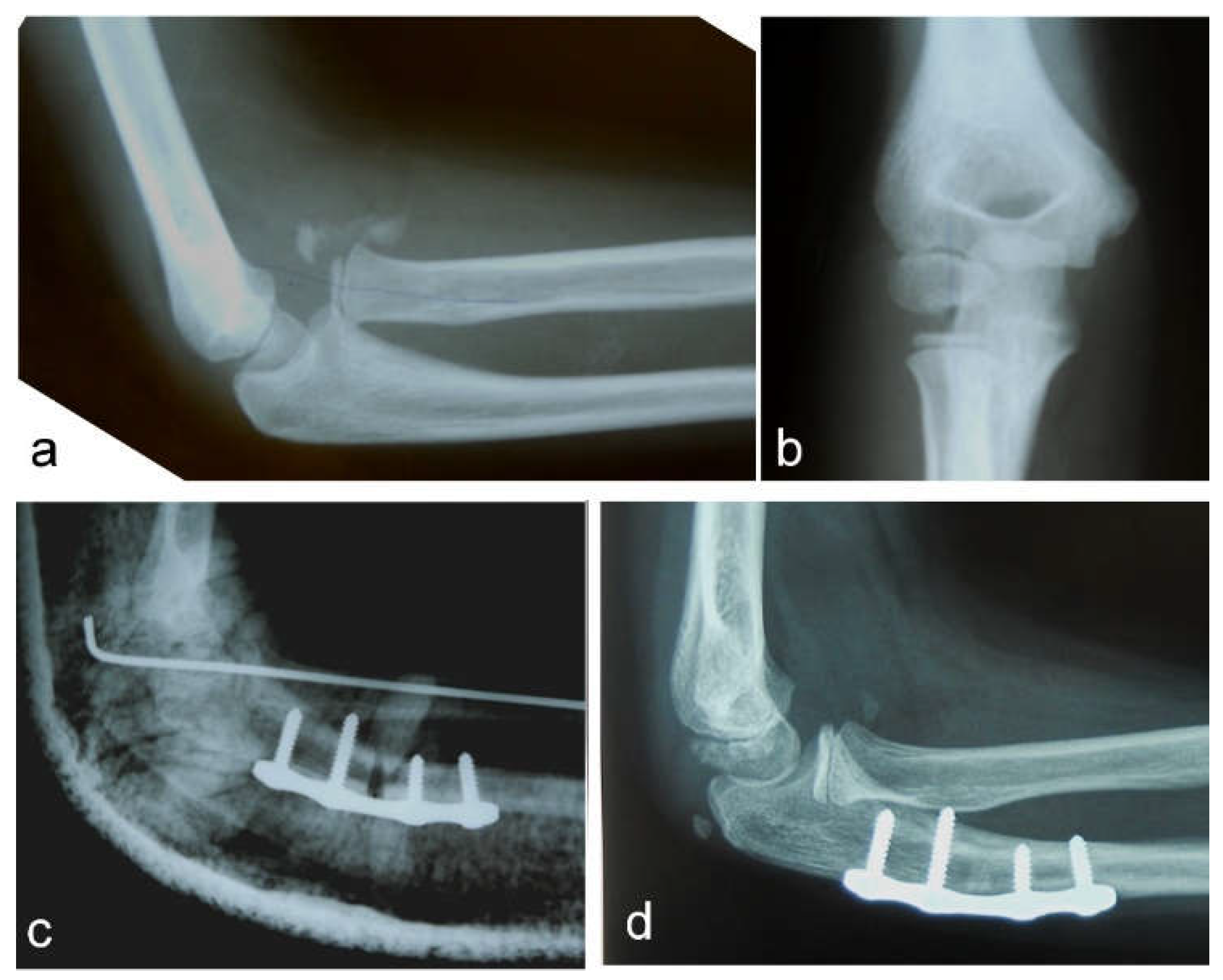 Children 09 01100 g001