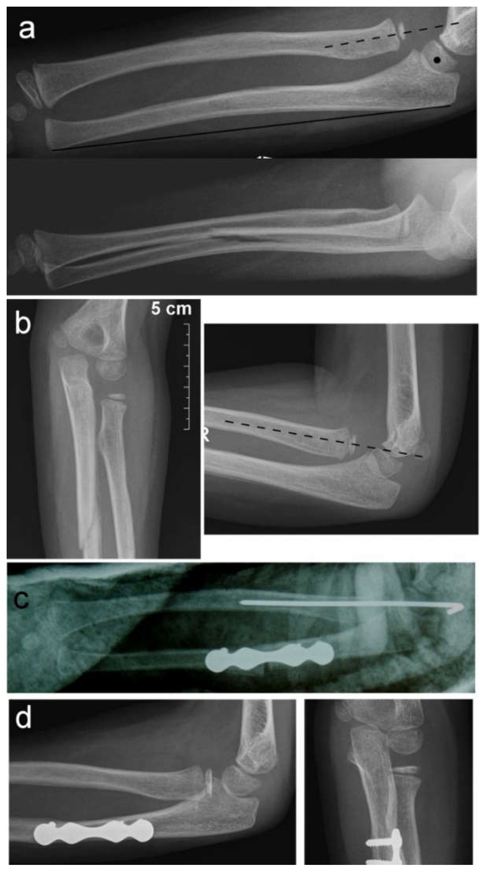 Children 09 01100 g002