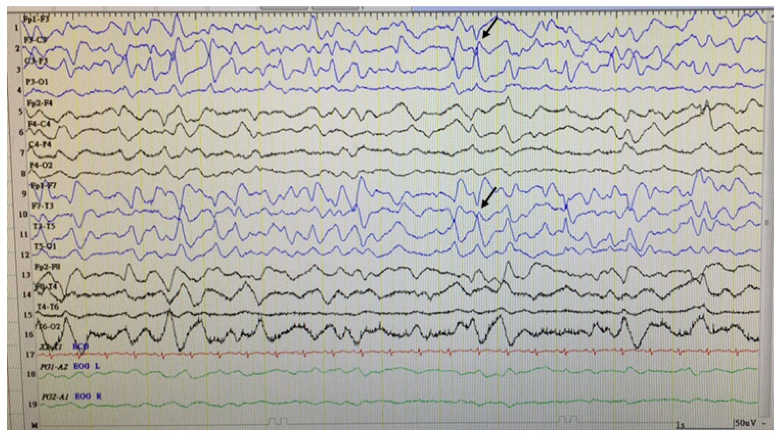 Children 09 01105 g001