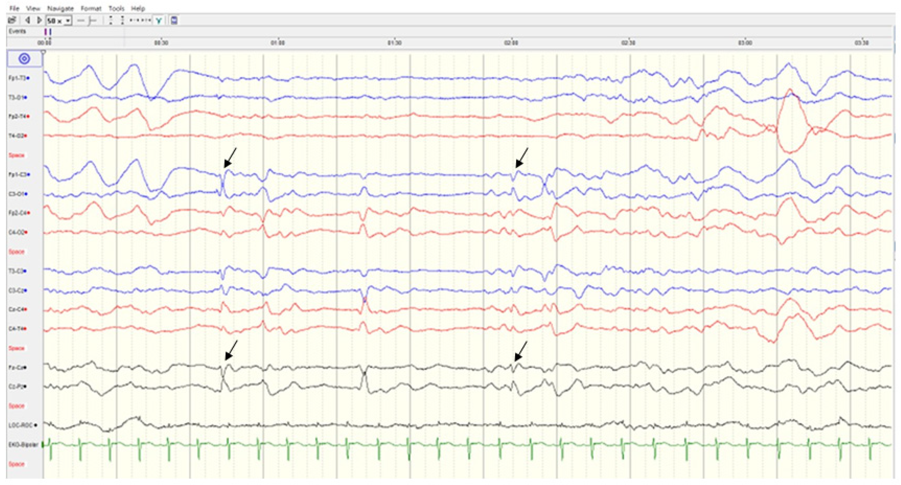 Children 09 01105 g004